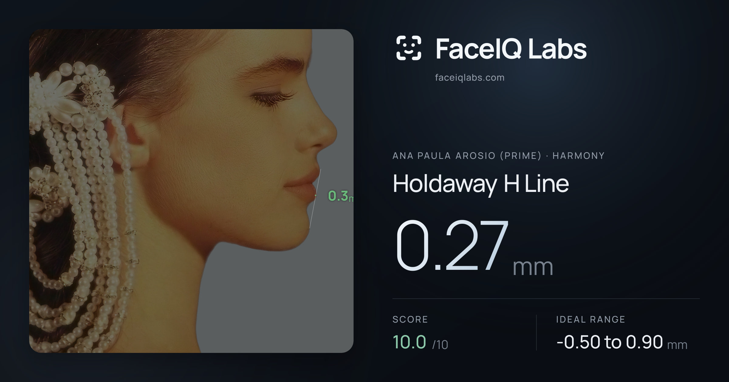 Ana paula arosio (prime) Holdaway H Line: 0.27mm, drawn on the photo