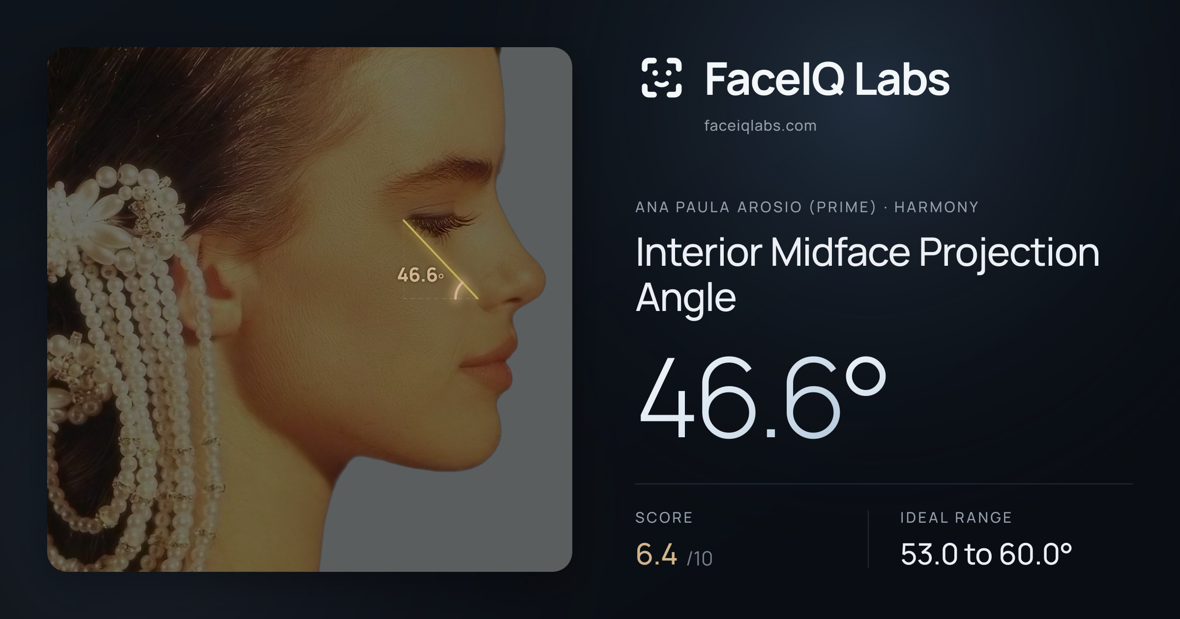 Ana paula arosio (prime) Interior Midface Projection Angle: 46.6°, drawn on the photo