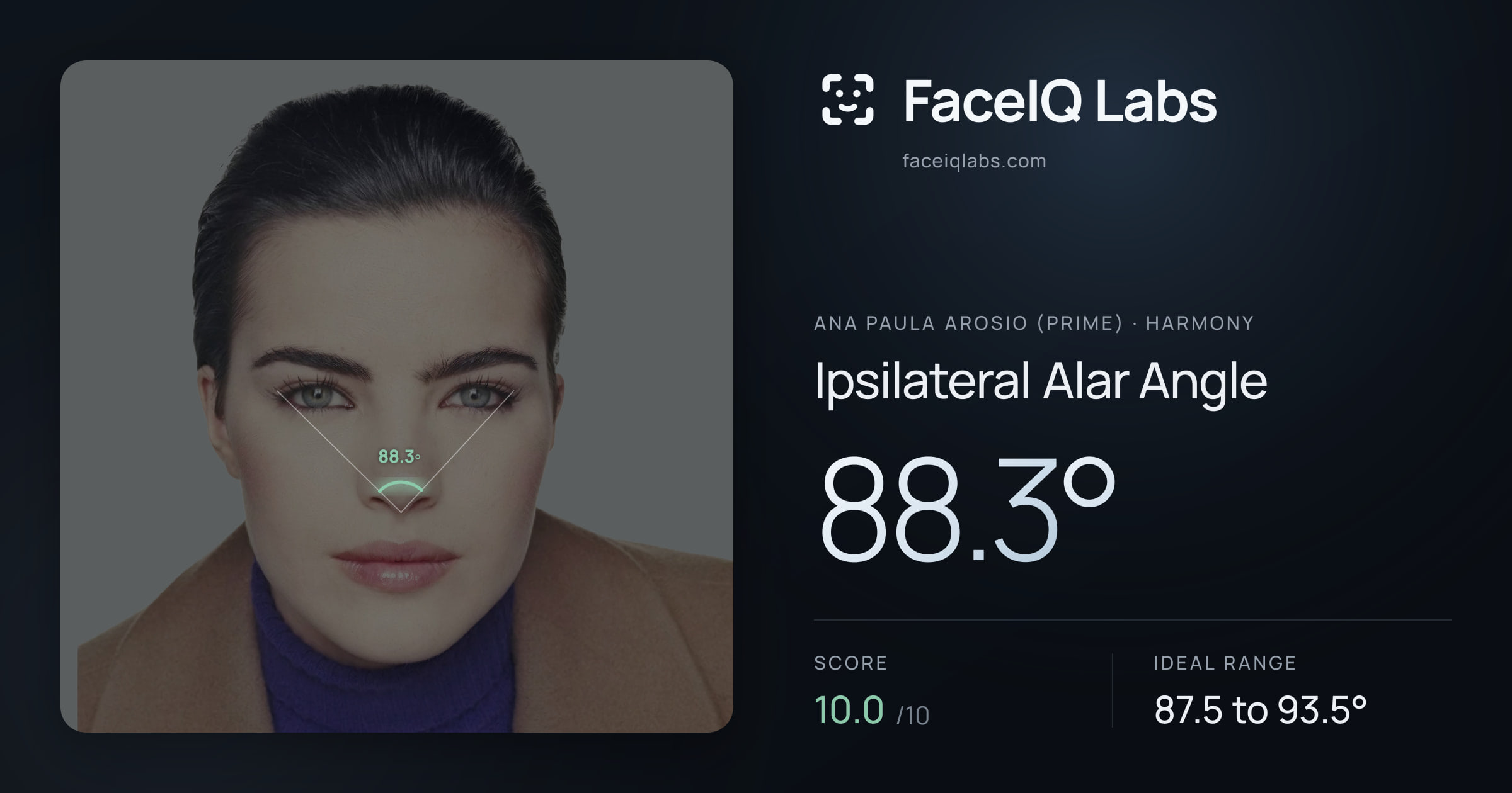 Ana paula arosio (prime) Ipsilateral Alar Angle: 88.3°, drawn on the photo