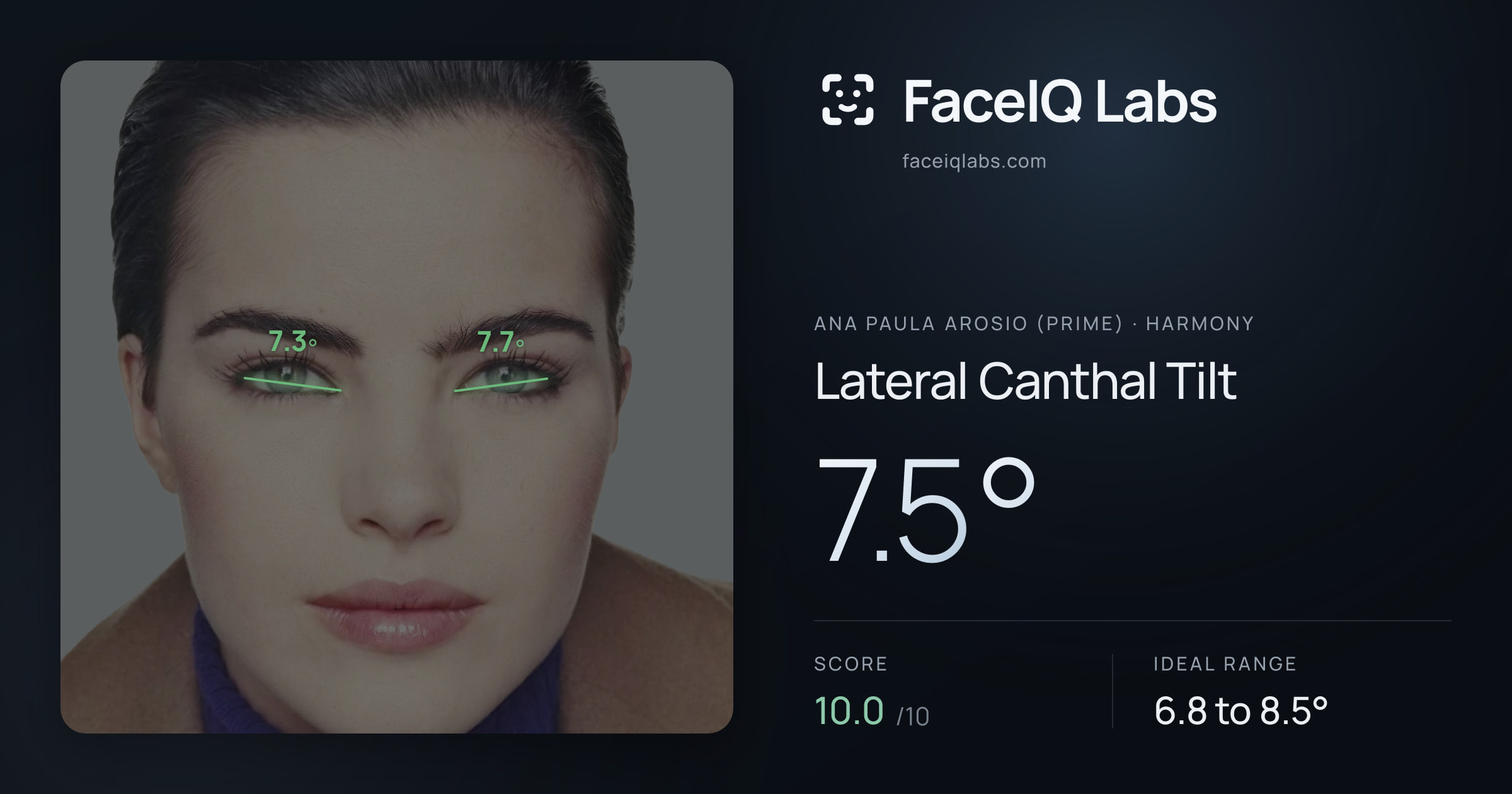 Ana paula arosio (prime) Lateral Canthal Tilt: 7.5°, drawn on the photo
