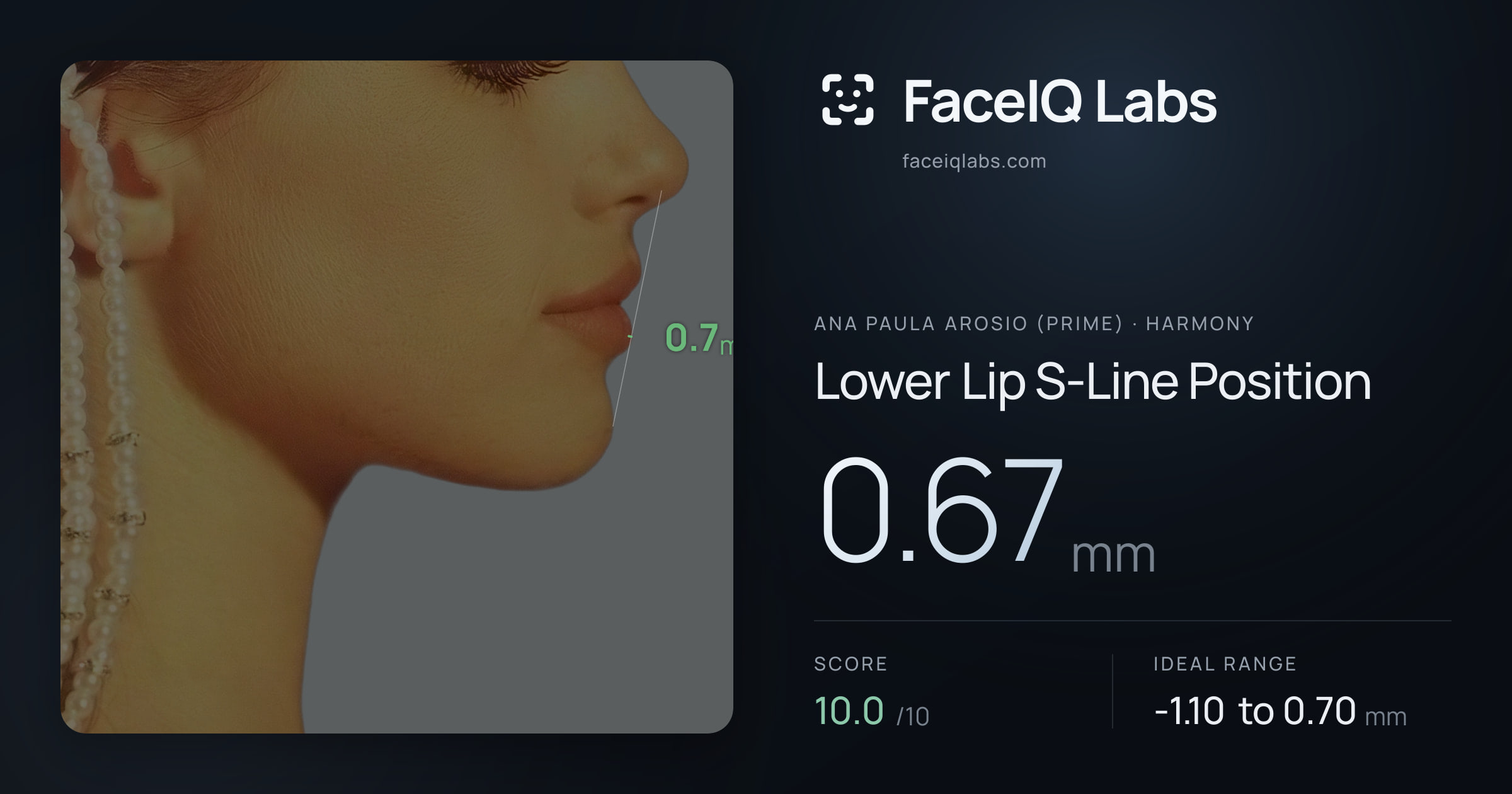 Ana paula arosio (prime) Lower Lip S-Line Position: 0.67mm, drawn on the photo