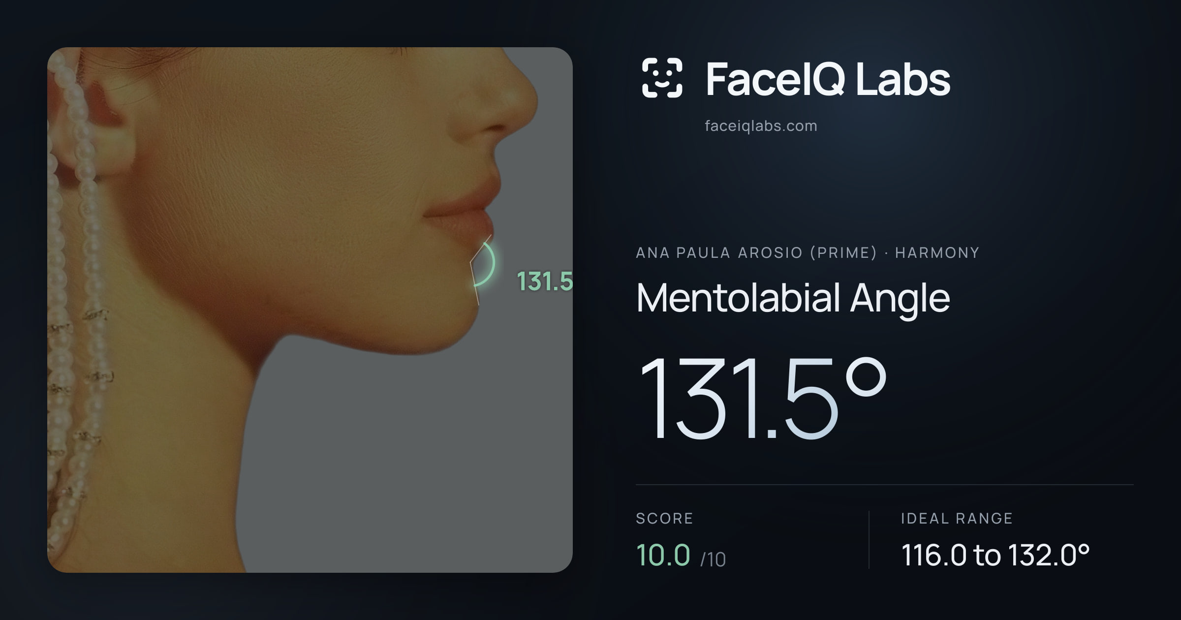 Ana paula arosio (prime) Mentolabial Angle: 131.5°, drawn on the photo