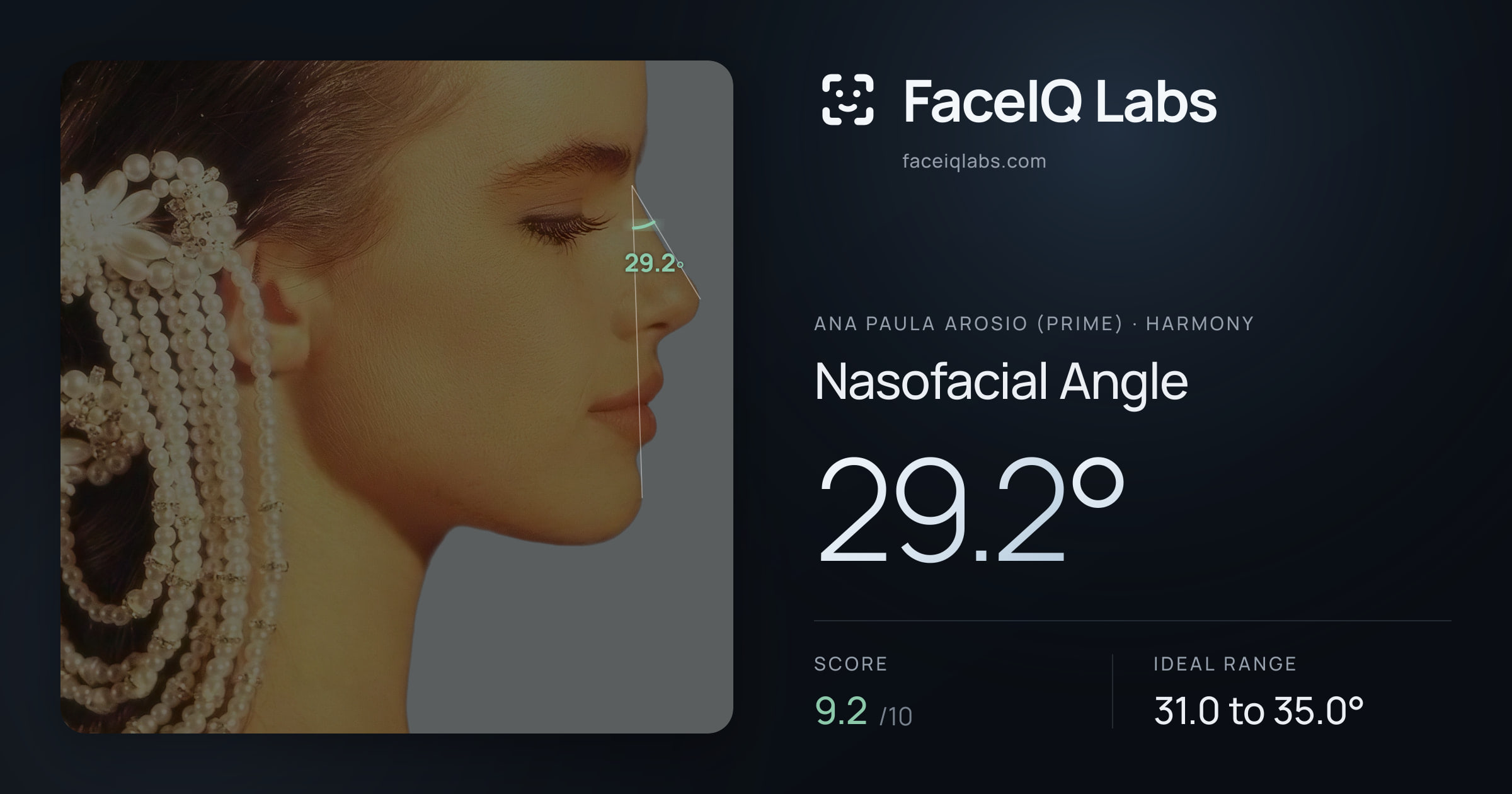 Ana paula arosio (prime) Nasofacial Angle: 29.2°, drawn on the photo