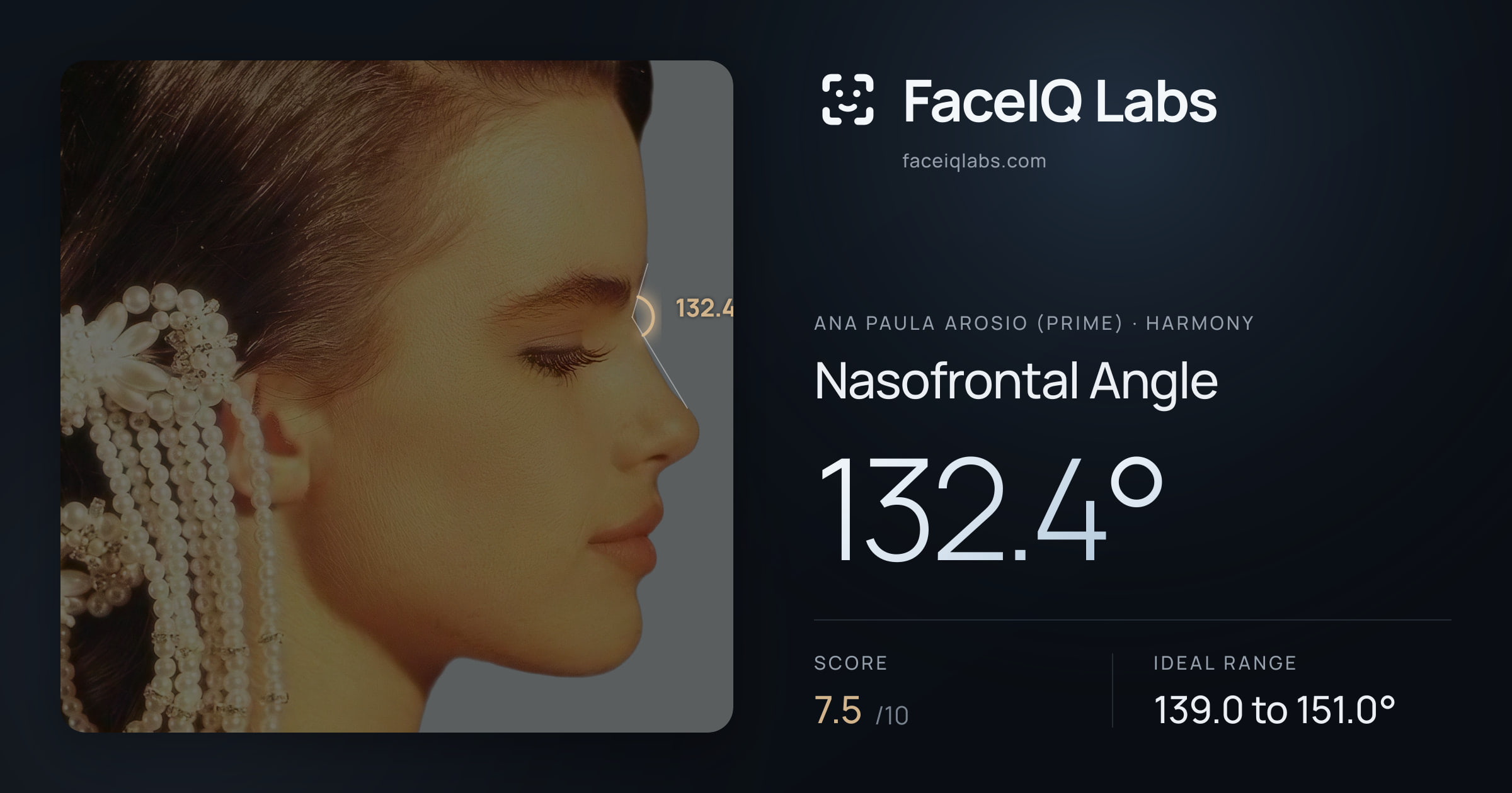 Ana paula arosio (prime) Nasofrontal Angle: 132.4°, drawn on the photo
