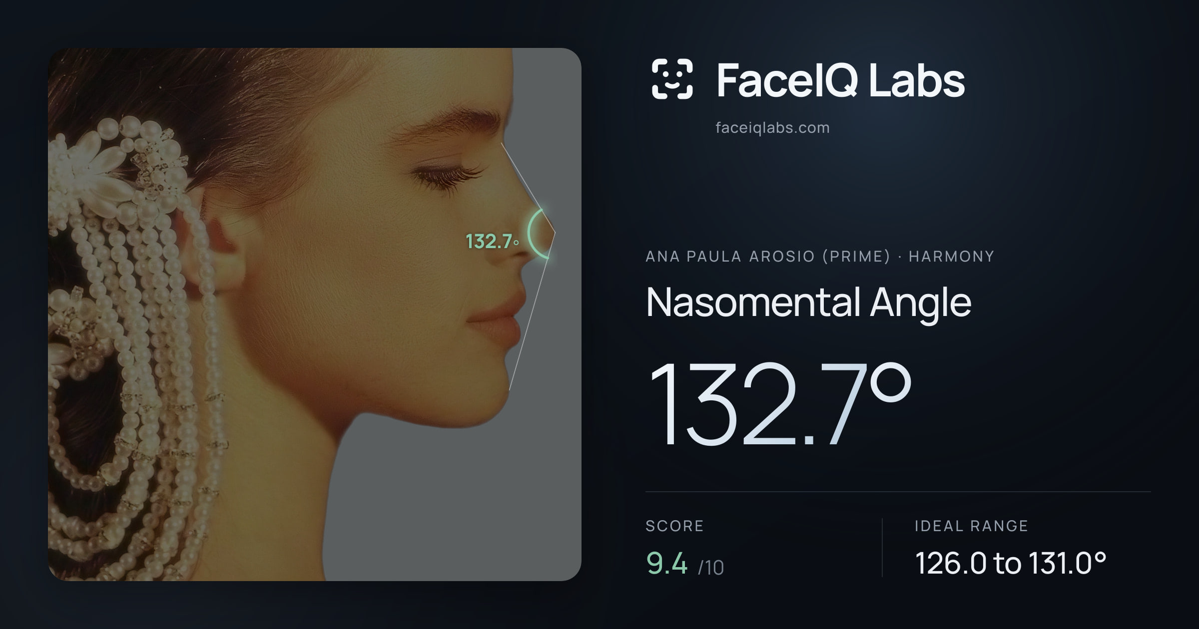 Ana paula arosio (prime) Nasomental Angle: 132.7°, drawn on the photo