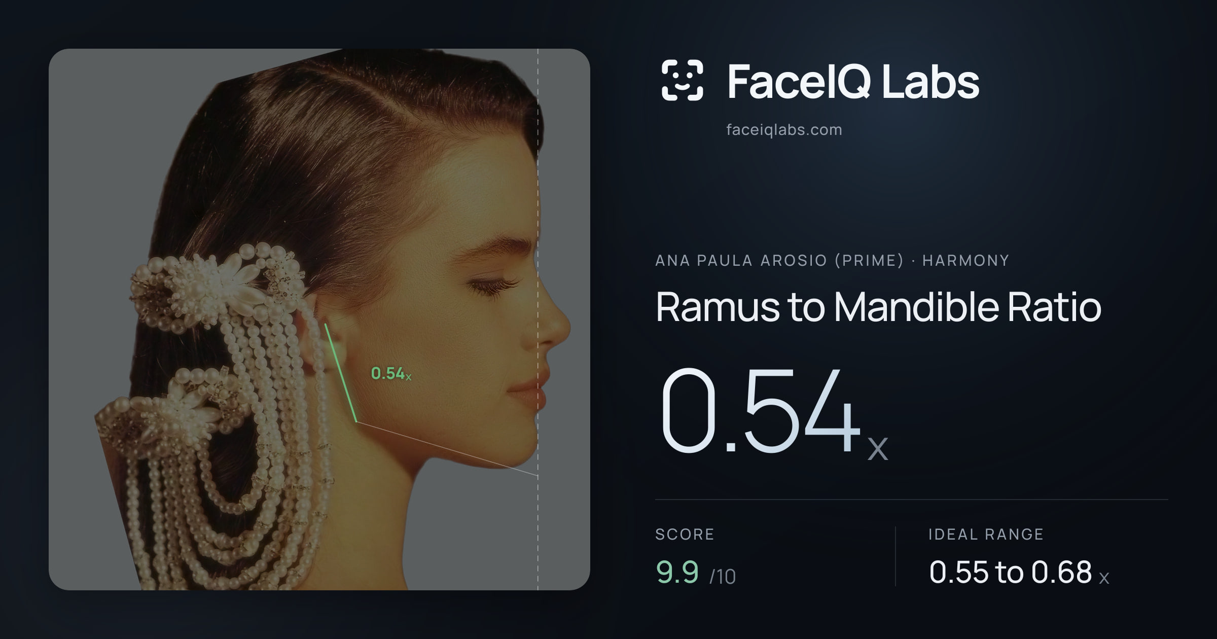Ana paula arosio (prime) Ramus to Mandible Ratio: 0.54x, drawn on the photo