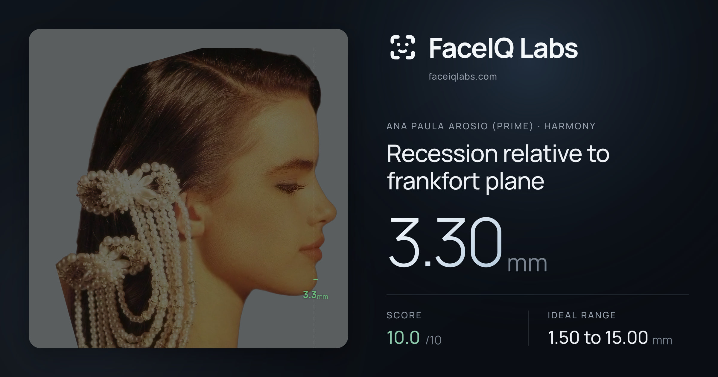 Ana paula arosio (prime) Recession relative to frankfort plane: 3.30mm, drawn on the photo