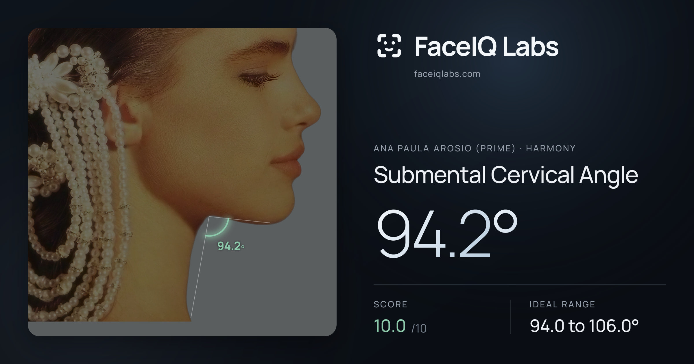 Ana paula arosio (prime) Submental Cervical Angle: 94.2°, drawn on the photo