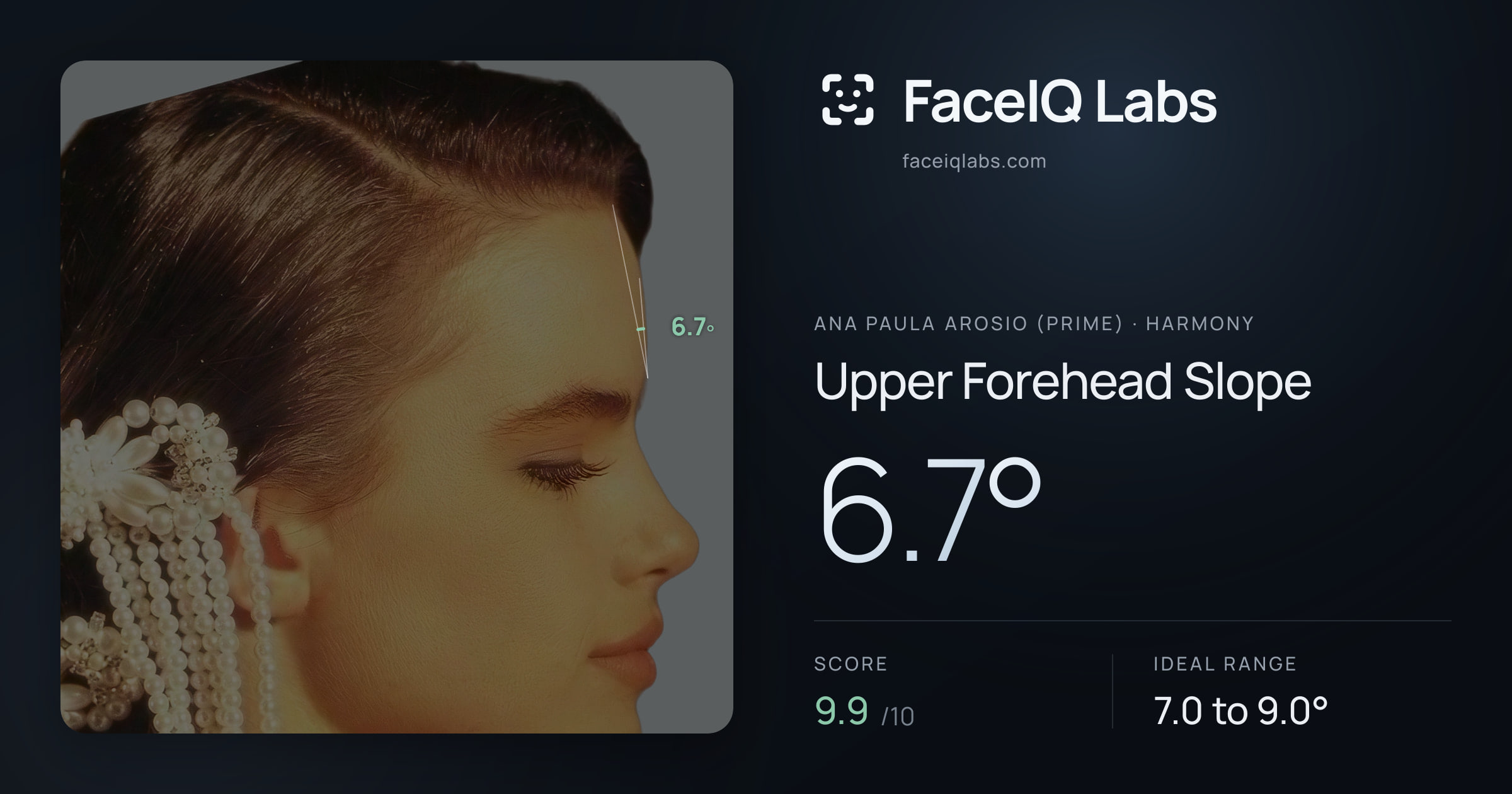 Ana paula arosio (prime) Upper Forehead Slope: 6.7°, drawn on the photo