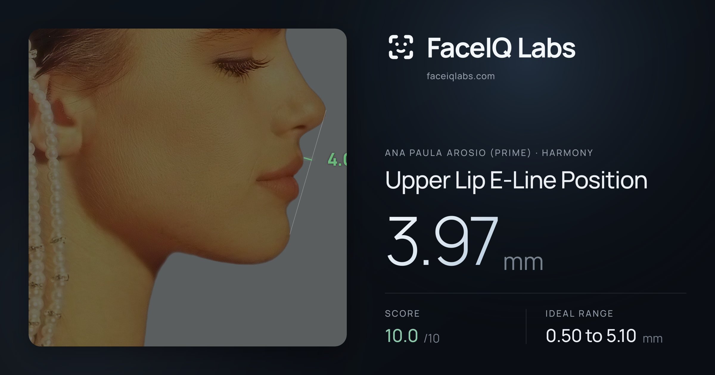 Ana paula arosio (prime) Upper Lip E-Line Position: 3.97mm, drawn on the photo