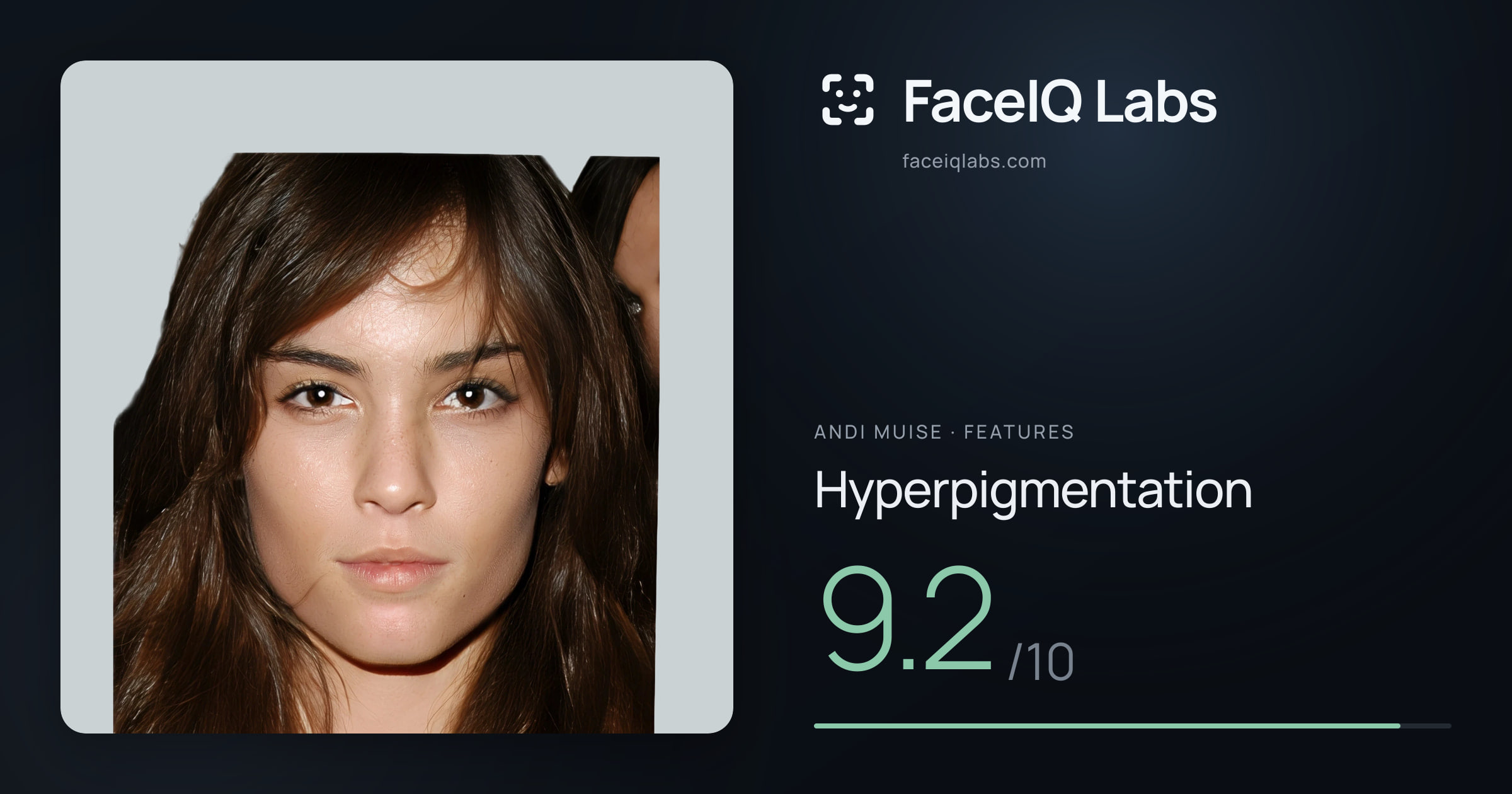 Andi Muise Hyperpigmentation: 9.2/10, drawn on the photo