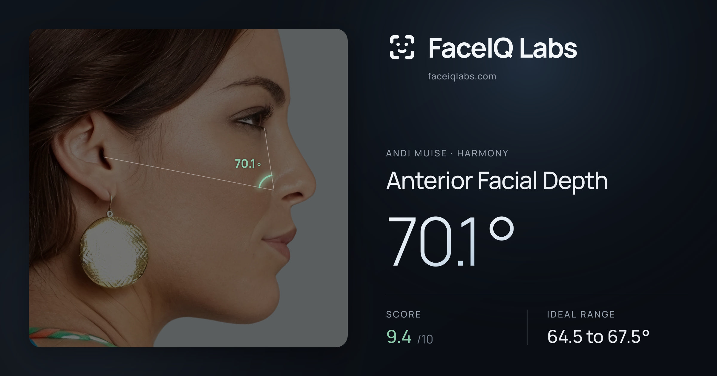 Andi Muise Anterior Facial Depth: 70.1°, drawn on the photo