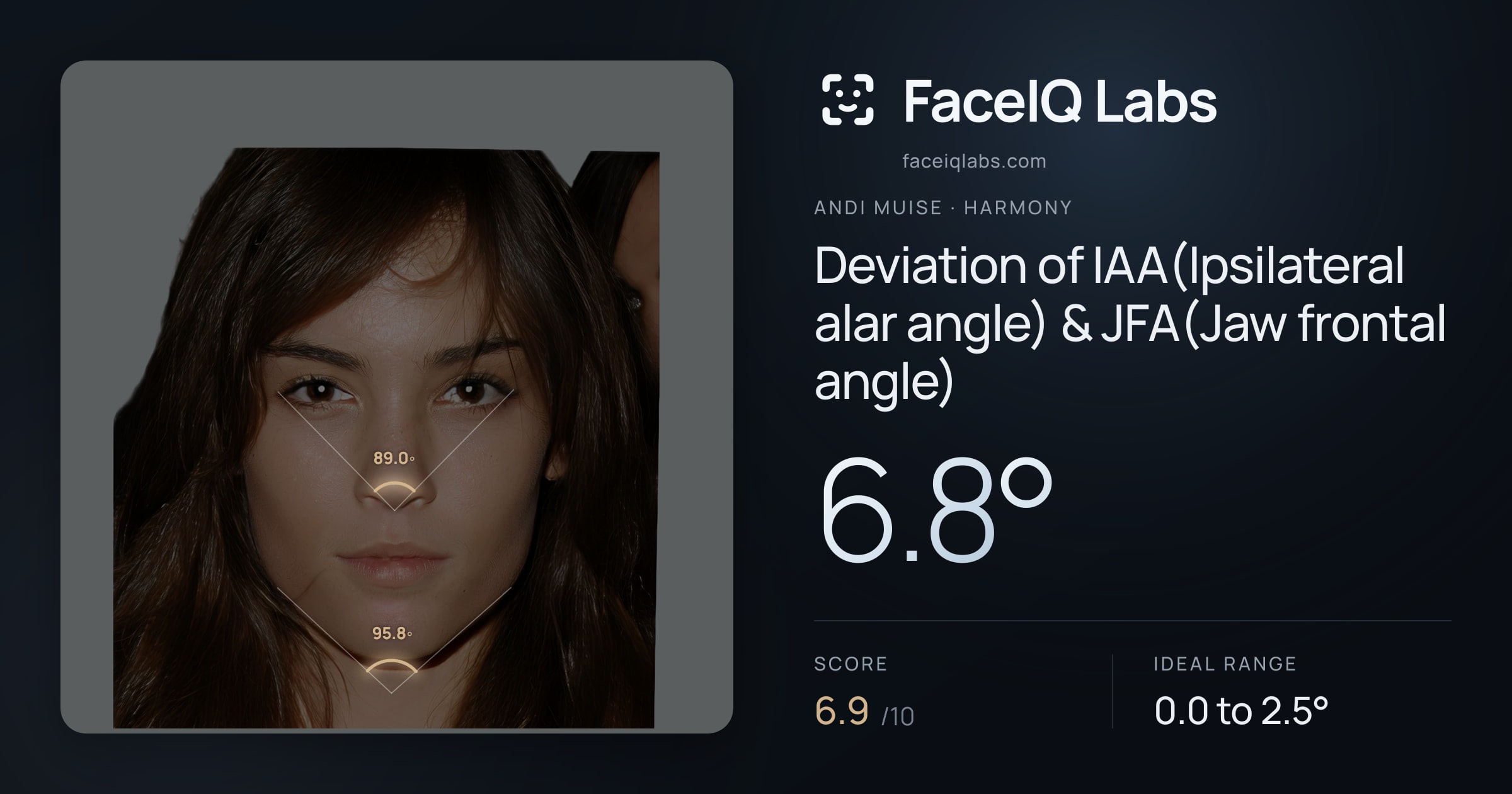 Andi Muise Deviation of IAA(Ipsilateral alar angle) & JFA(Jaw frontal angle): 6.8°, drawn on the photo
