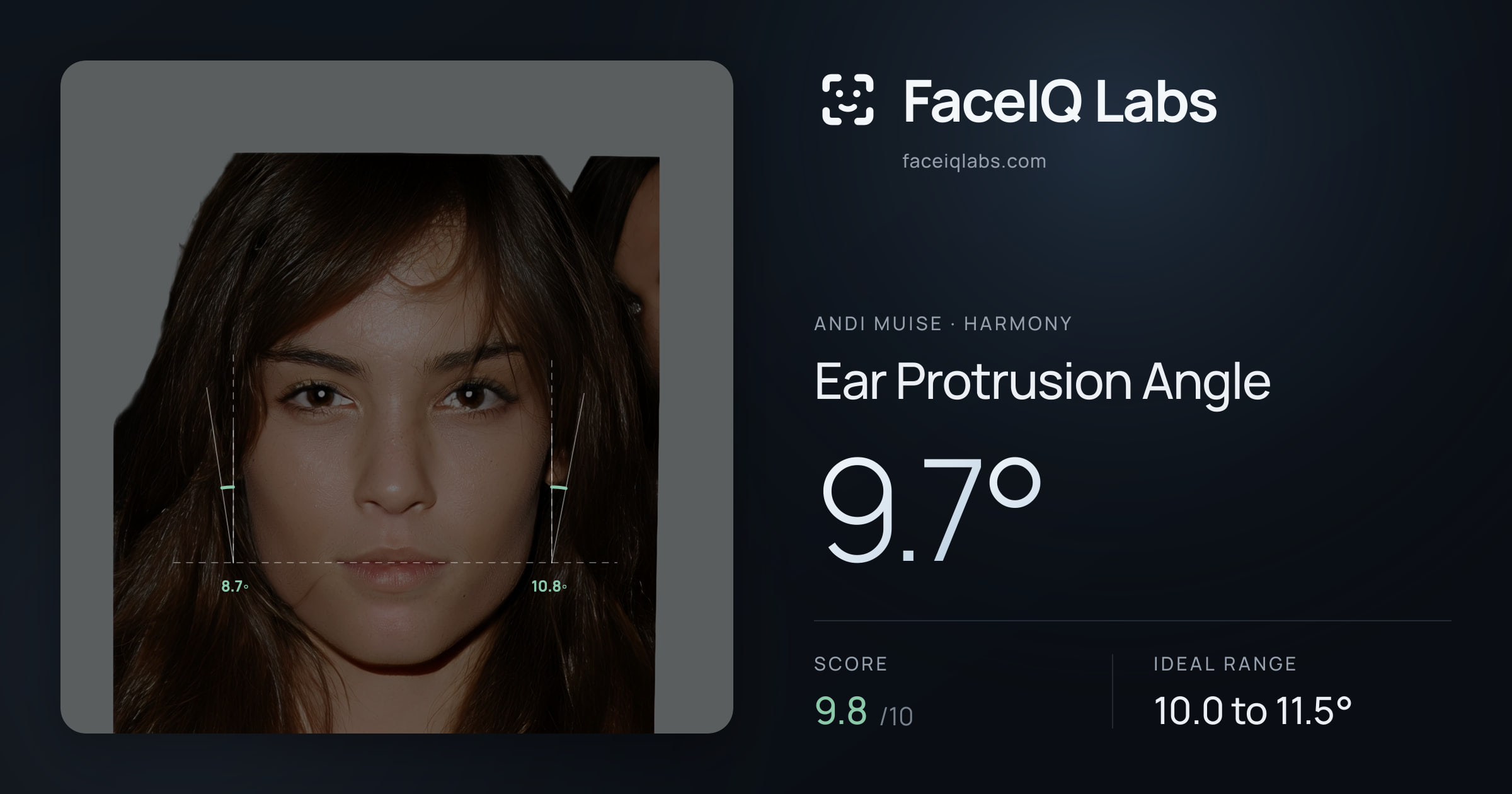 Andi Muise Ear Protrusion Angle: 9.7°, drawn on the photo
