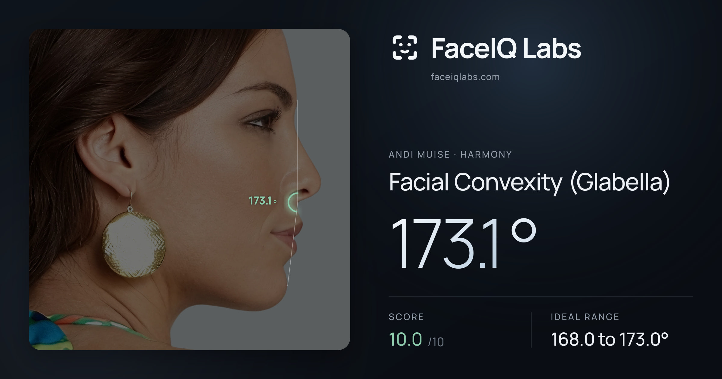 Andi Muise Facial Convexity (Glabella): 173.1°, drawn on the photo