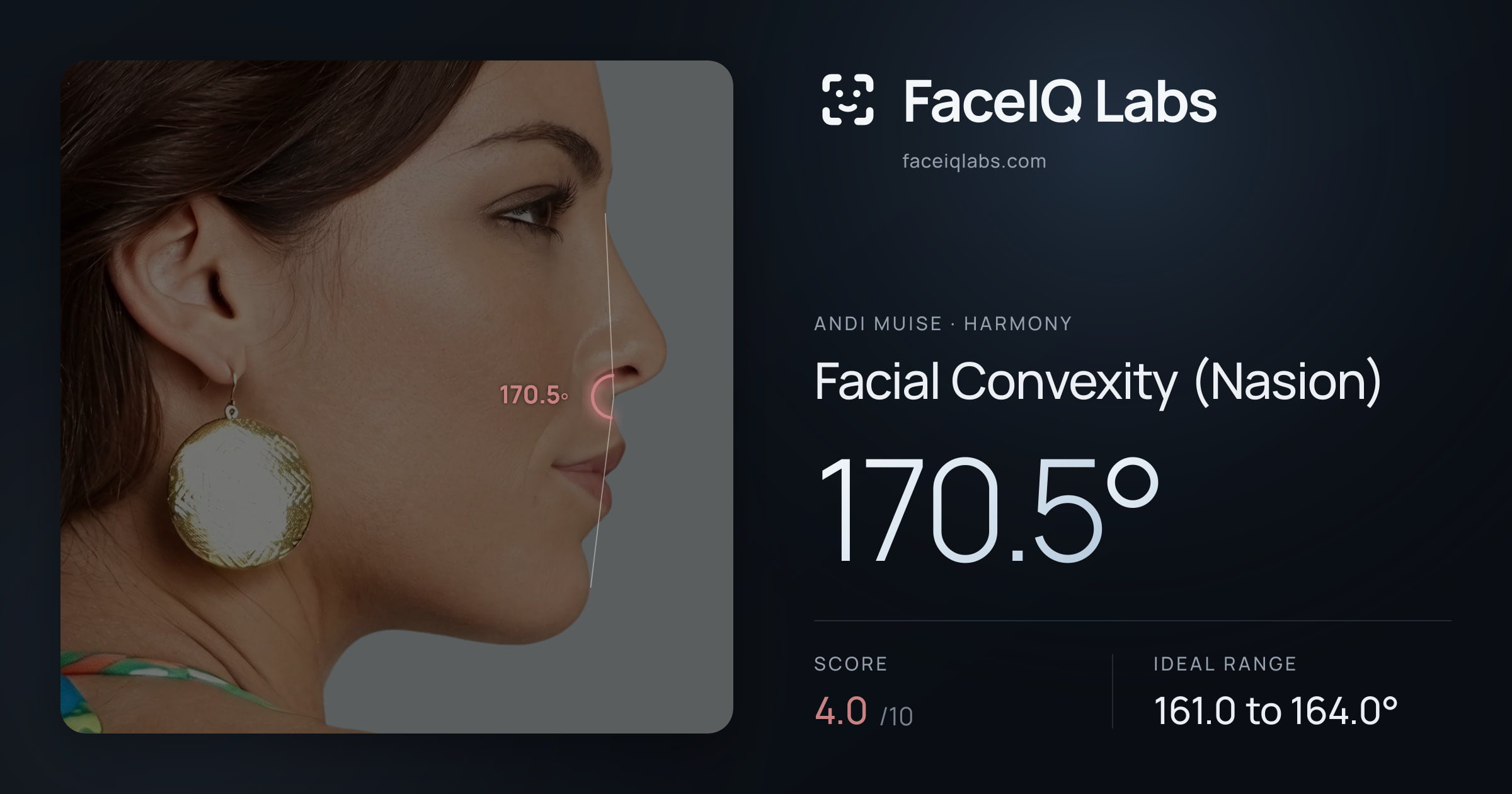 Andi Muise Facial Convexity (Nasion): 170.5°, drawn on the photo