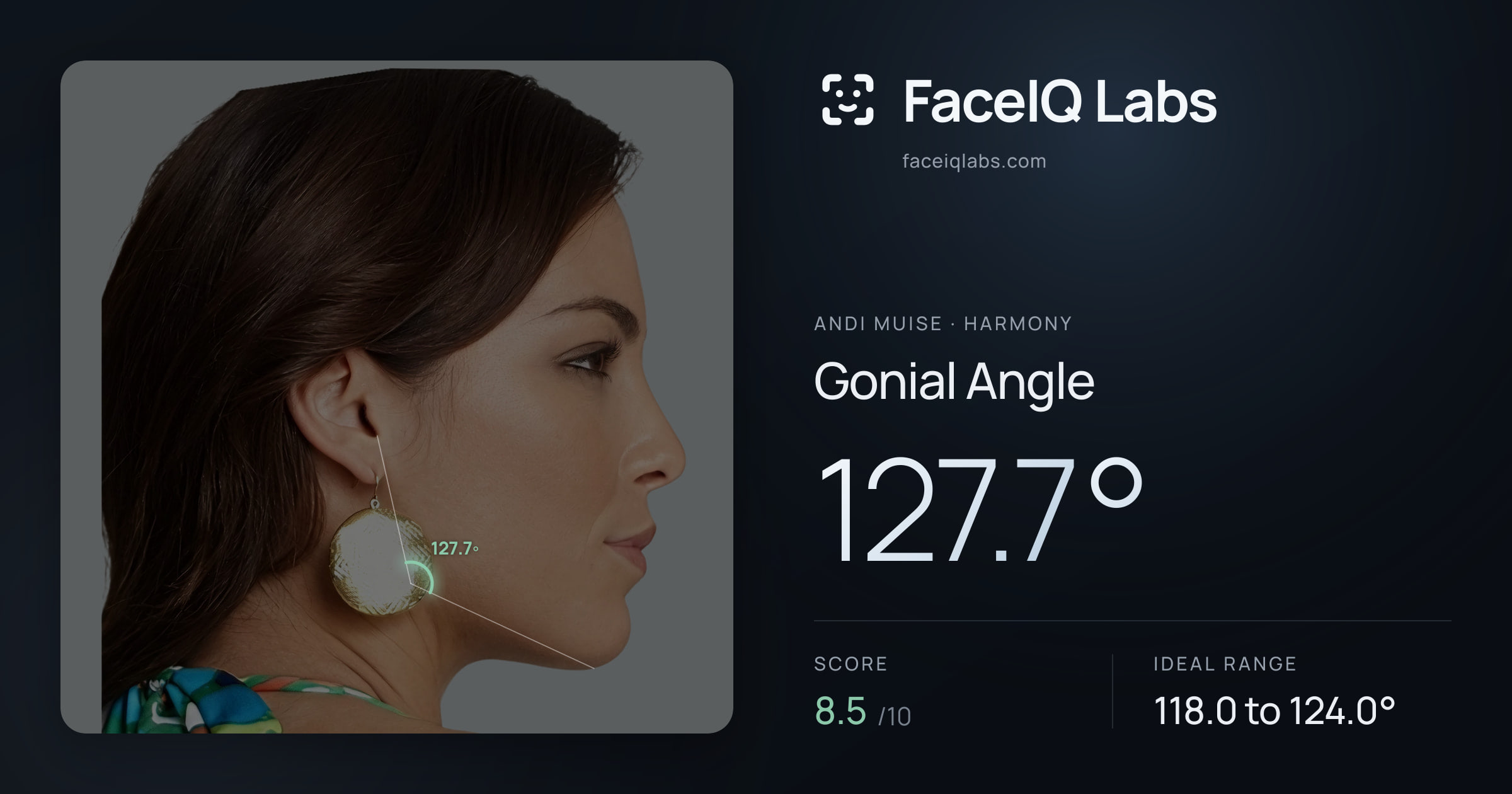 Andi Muise Gonial Angle: 127.7°, drawn on the photo