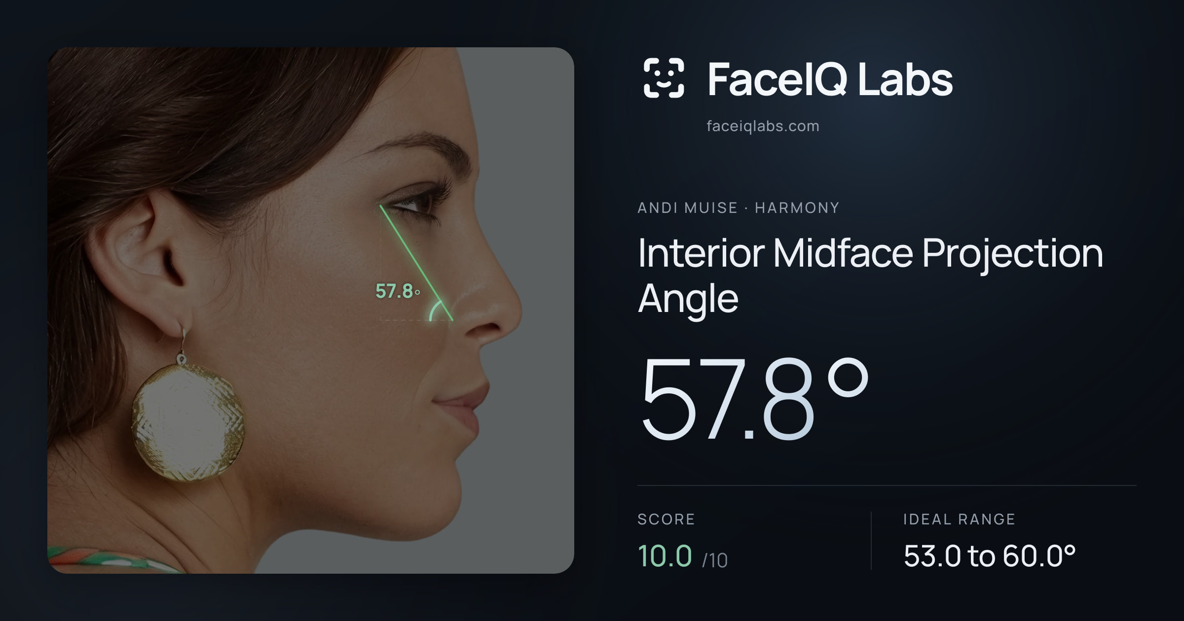 Andi Muise Interior Midface Projection Angle: 57.8°, drawn on the photo