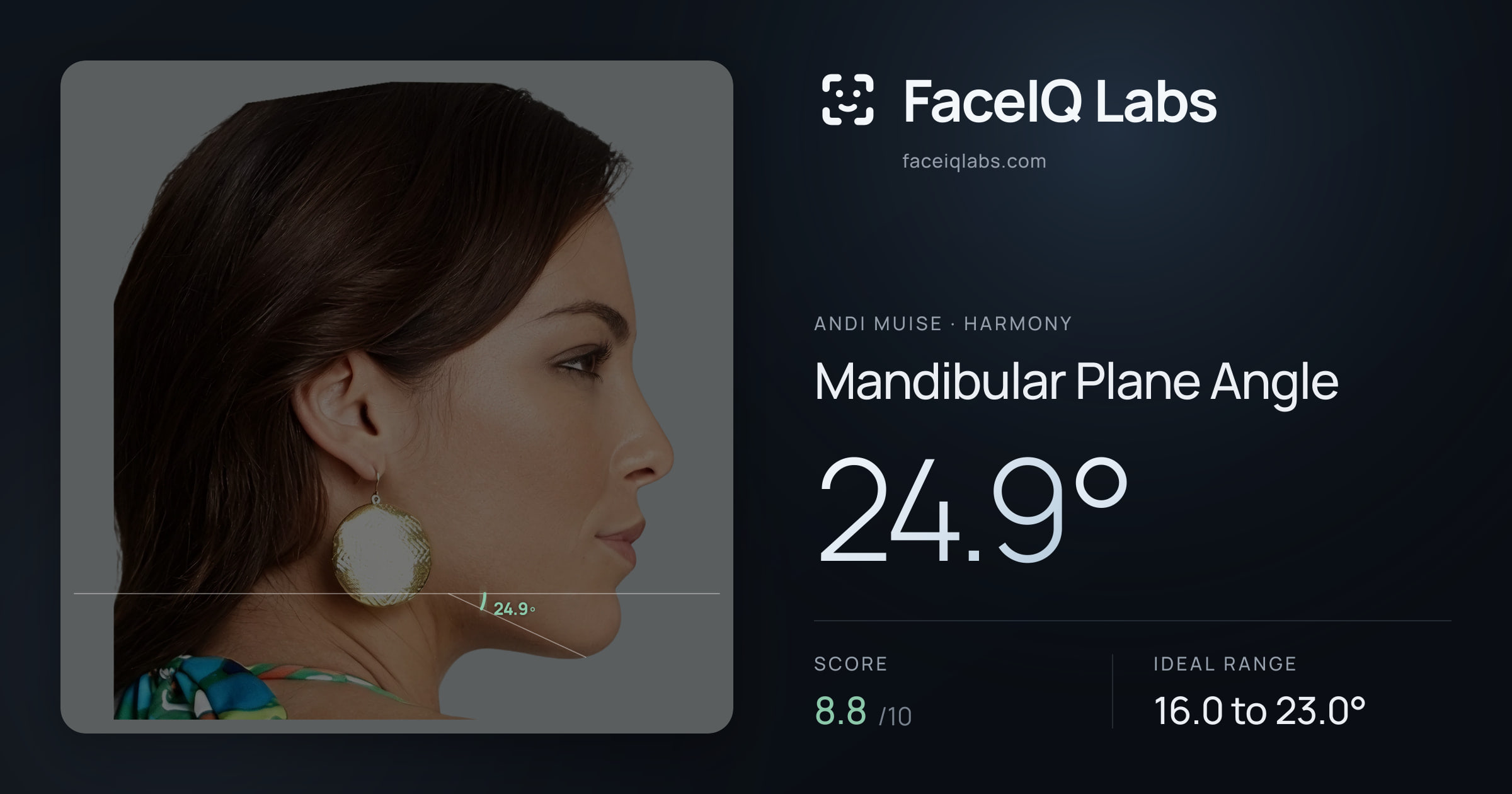 Andi Muise Mandibular Plane Angle: 24.9°, drawn on the photo