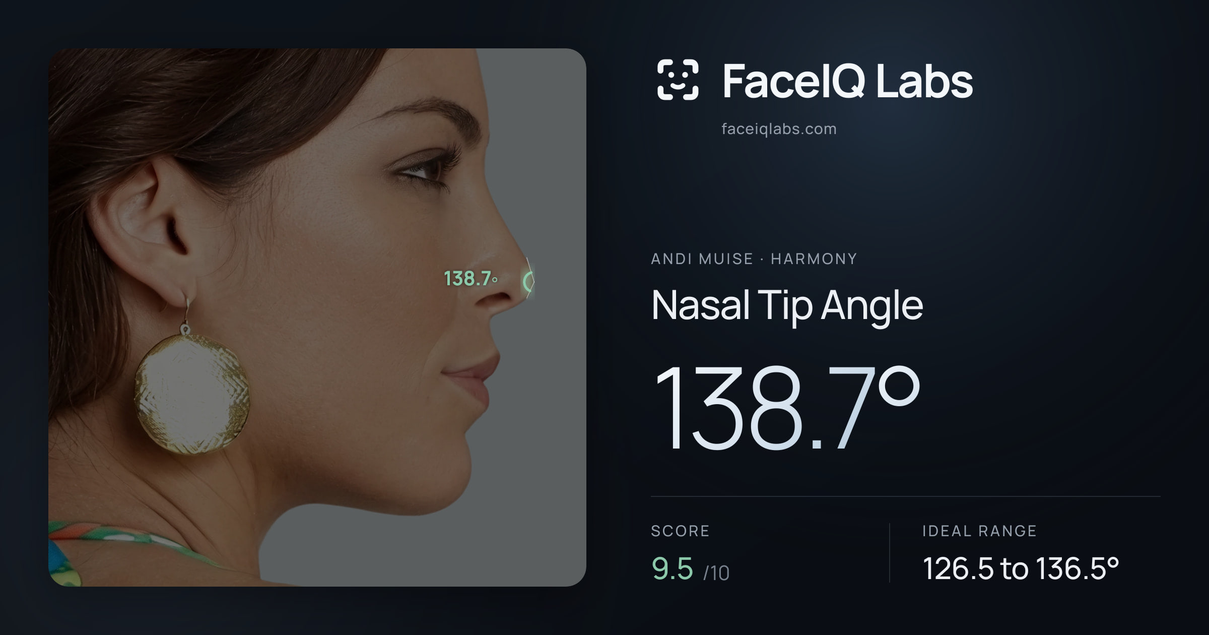 Andi Muise Nasal Tip Angle: 138.7°, drawn on the photo