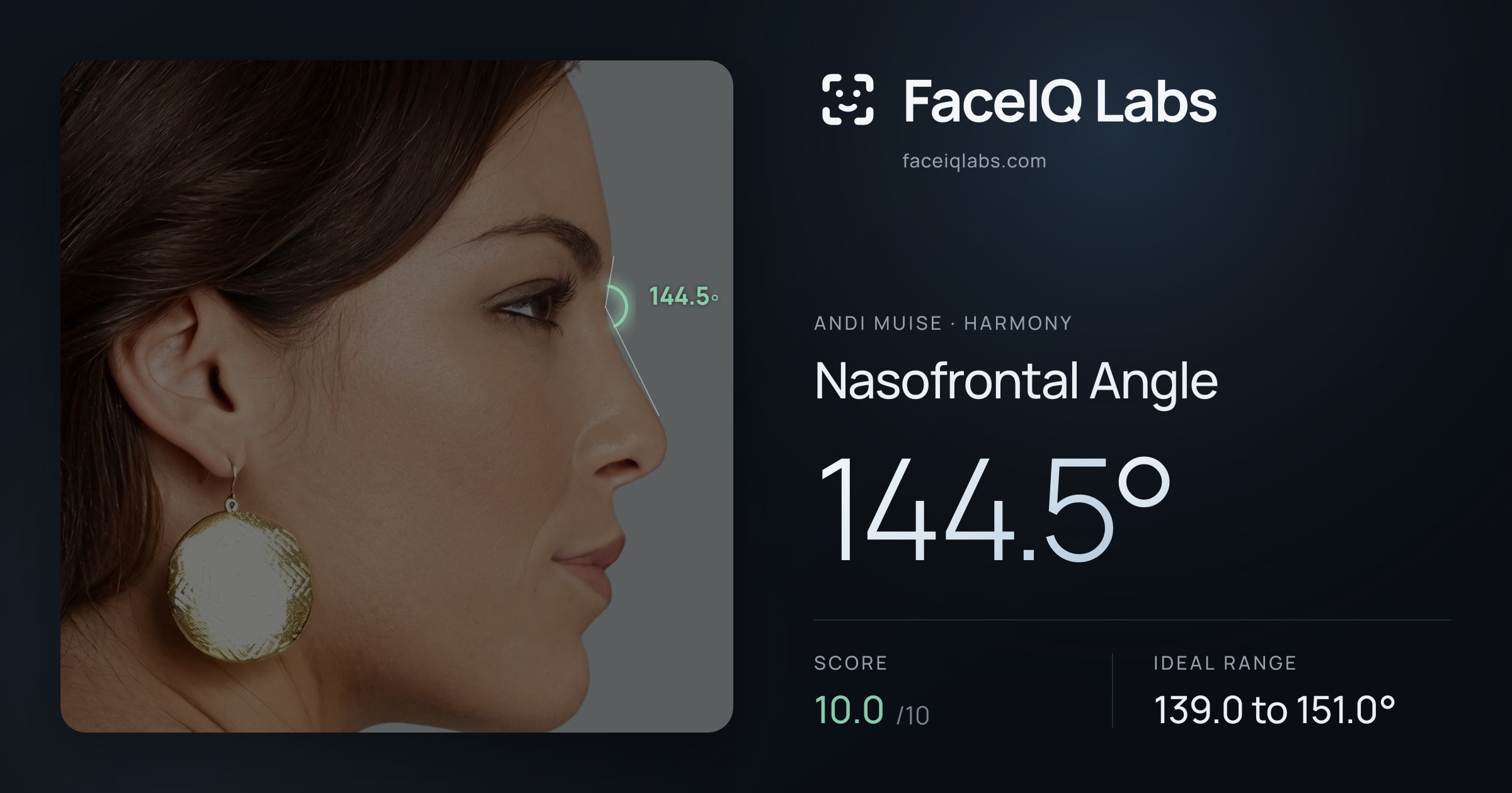 Andi Muise Nasofrontal Angle: 144.5°, drawn on the photo