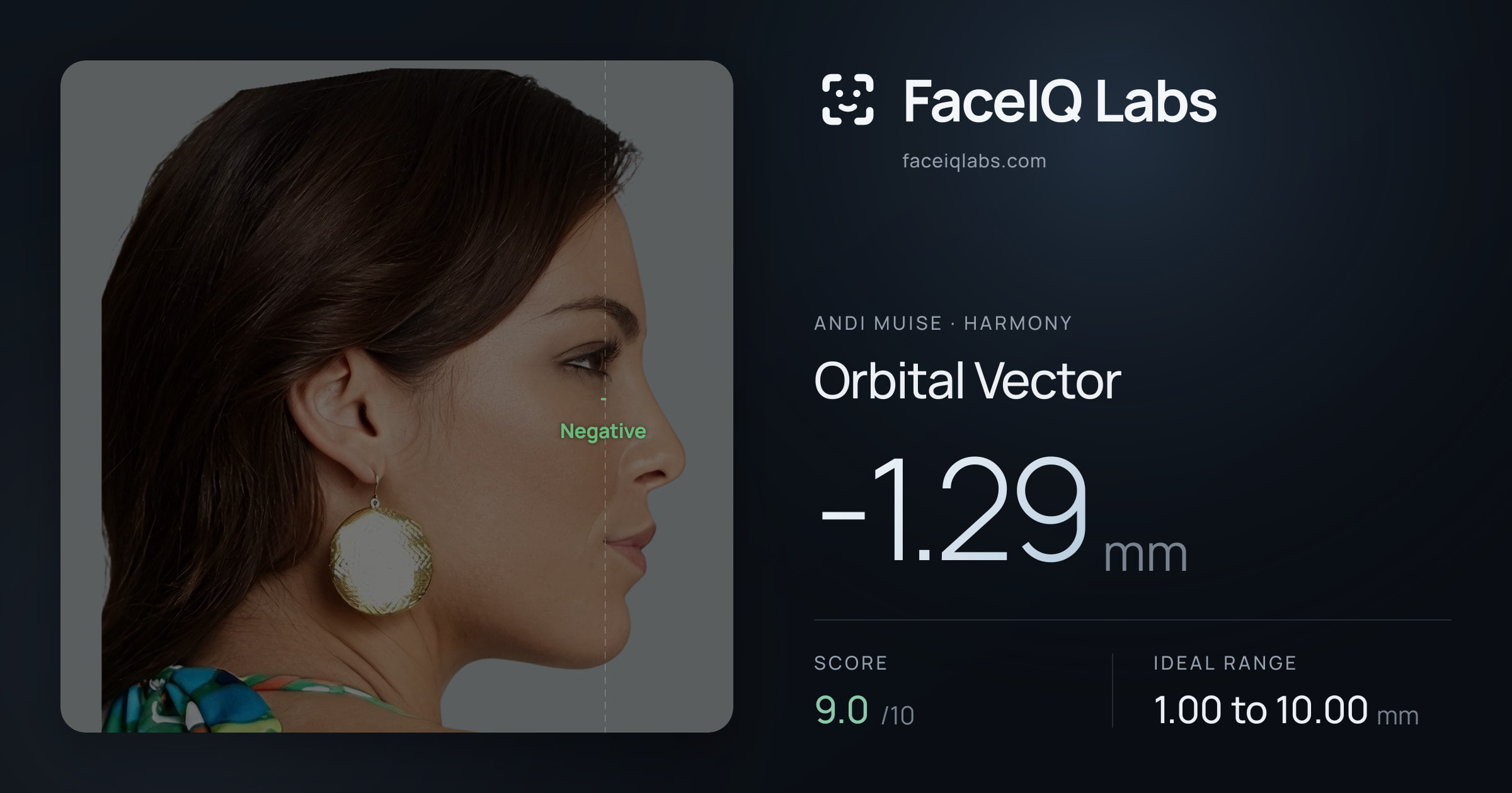 Andi Muise Orbital Vector: -1.29mm, drawn on the photo