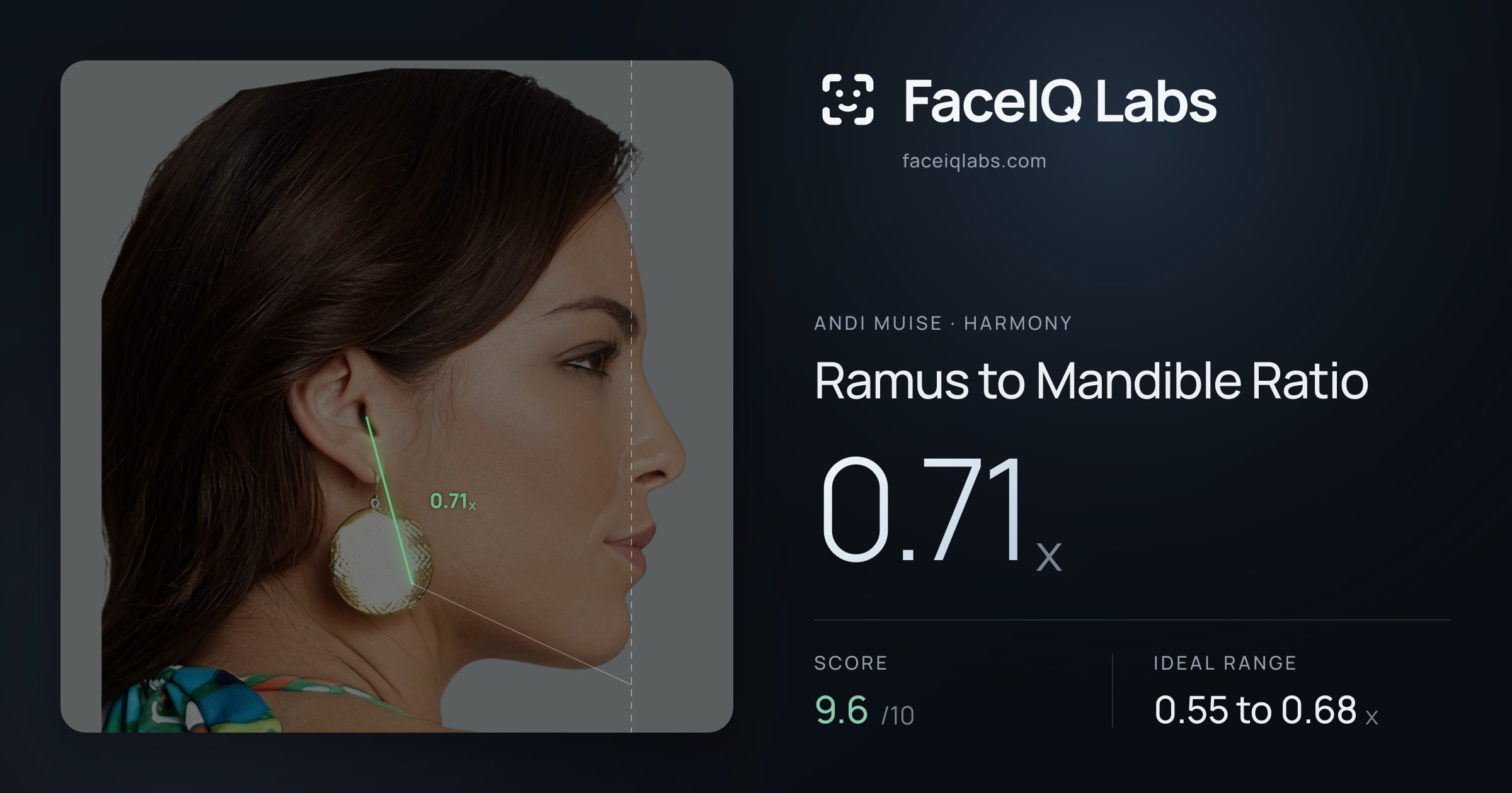 Andi Muise Ramus to Mandible Ratio: 0.71x, drawn on the photo
