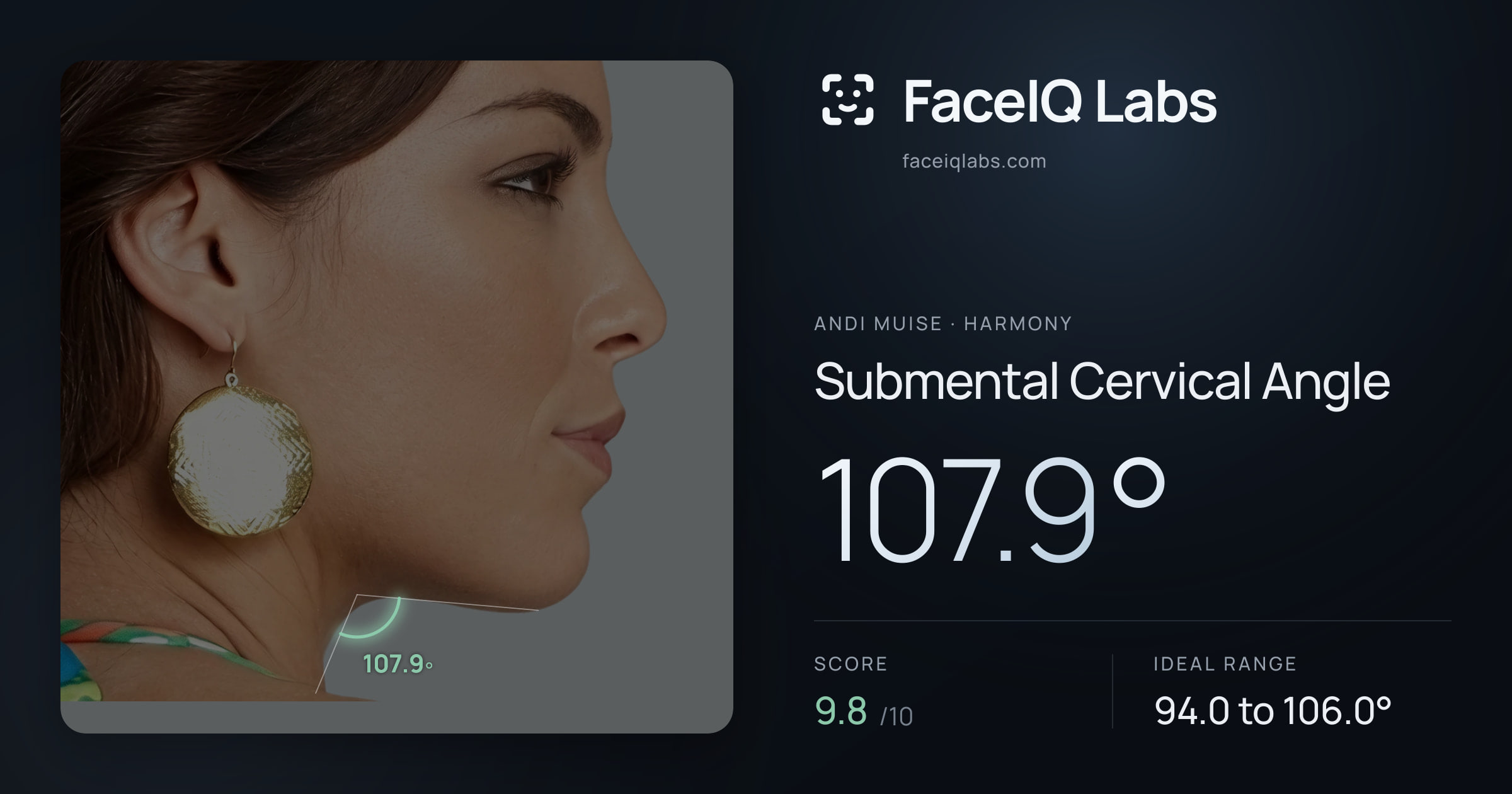 Andi Muise Submental Cervical Angle: 107.9°, drawn on the photo