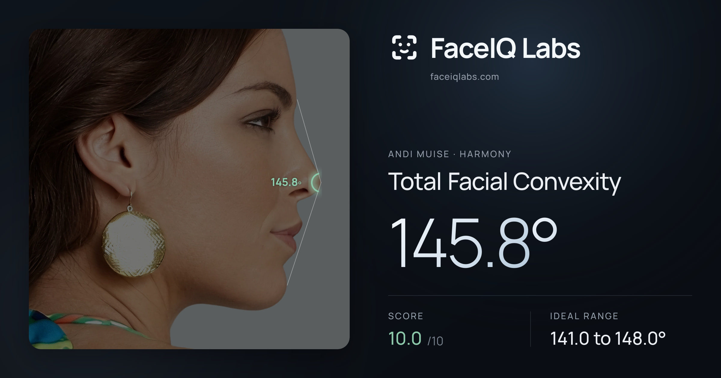 Andi Muise Total Facial Convexity: 145.8°, drawn on the photo