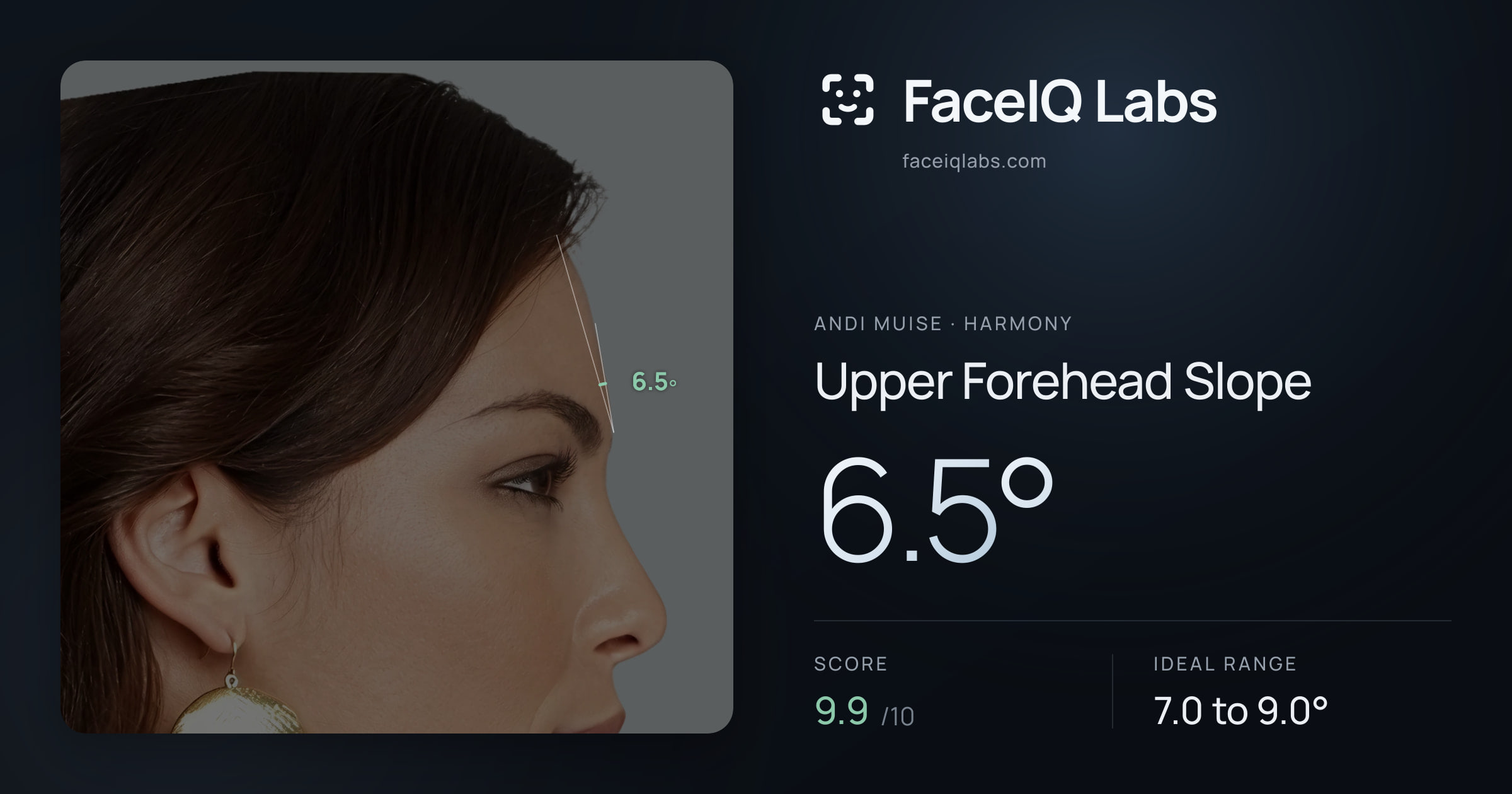 Andi Muise Upper Forehead Slope: 6.5°, drawn on the photo