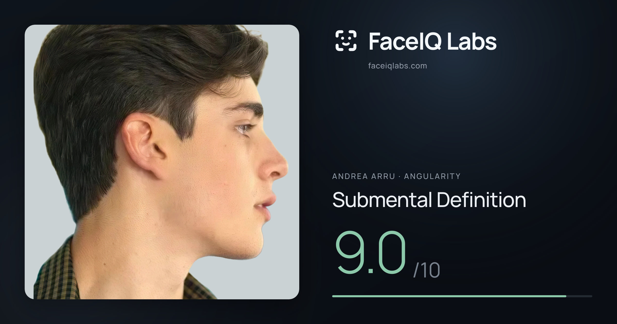 Andrea Arru Submental Definition: 9.0/10, drawn on the photo
