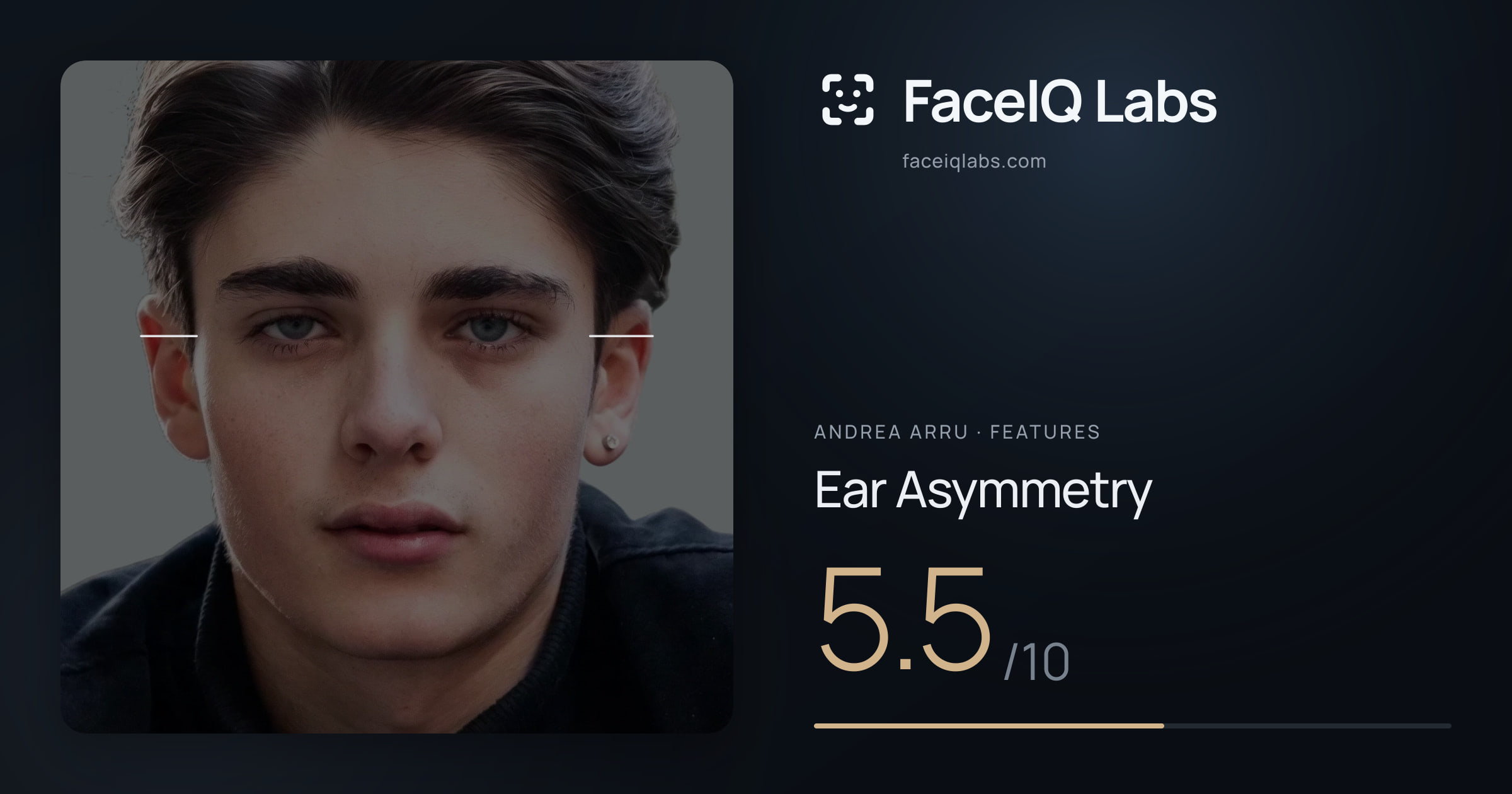 Andrea Arru Ear Asymmetry: 5.5/10, drawn on the photo