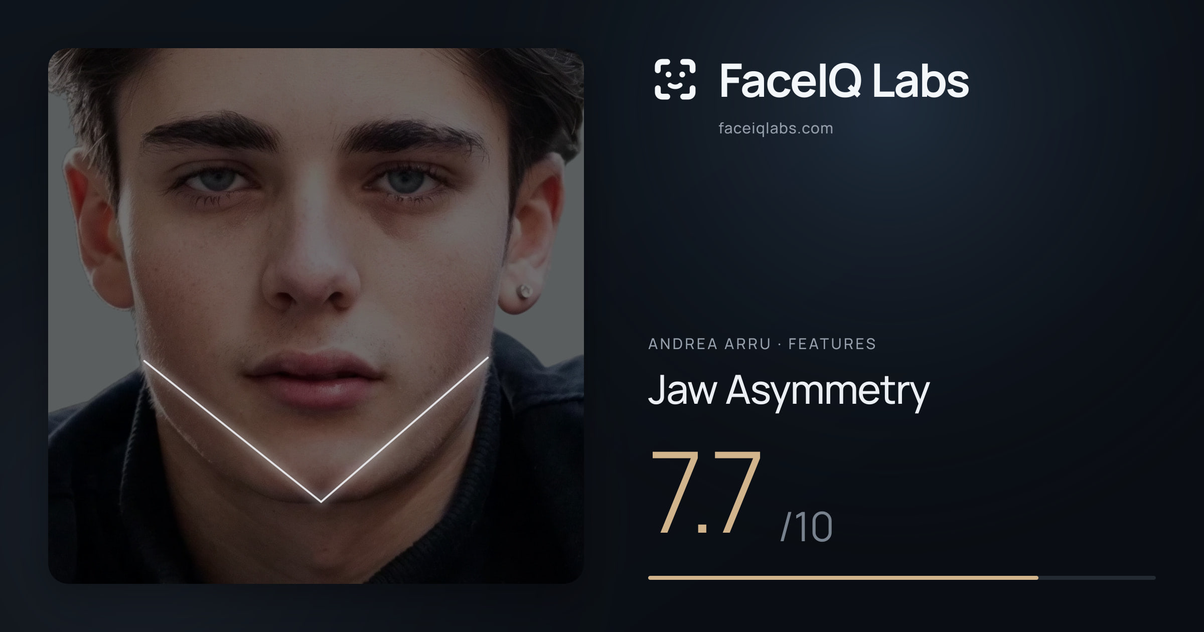 Andrea Arru Jaw Asymmetry: 7.7/10, drawn on the photo