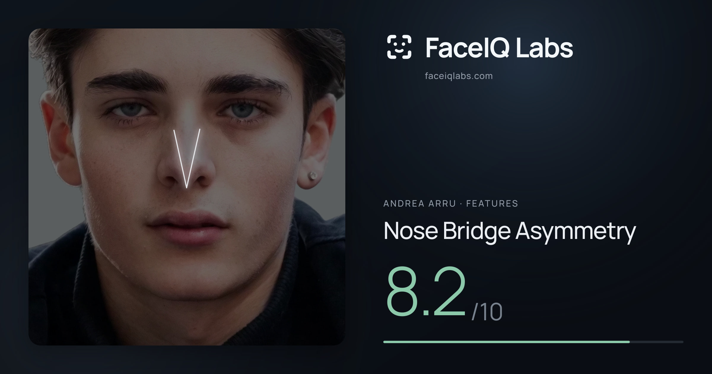 Andrea Arru Nose Bridge Asymmetry: 8.2/10, drawn on the photo