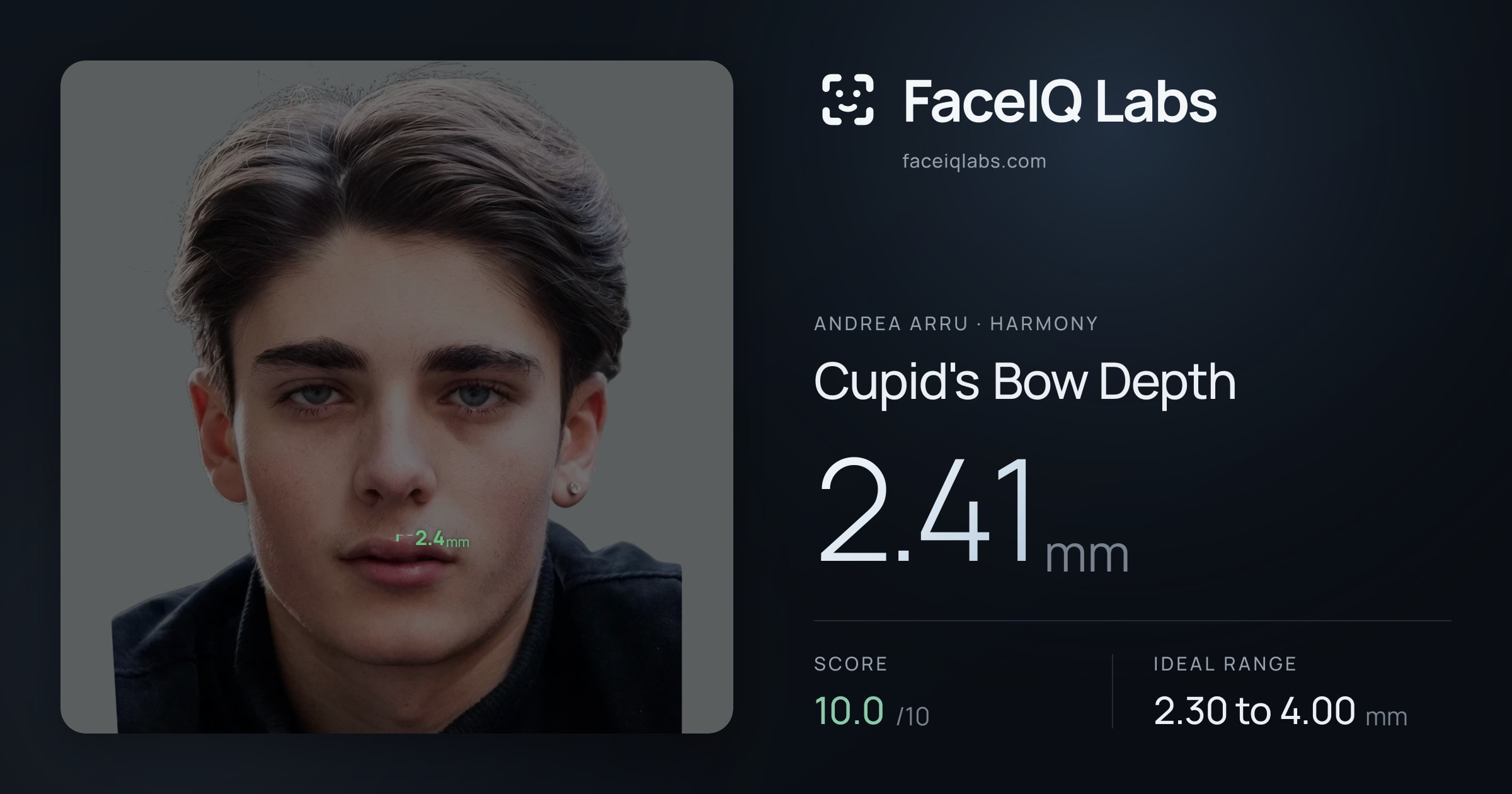 Andrea Arru Cupid's Bow Depth: 2.41mm, drawn on the photo