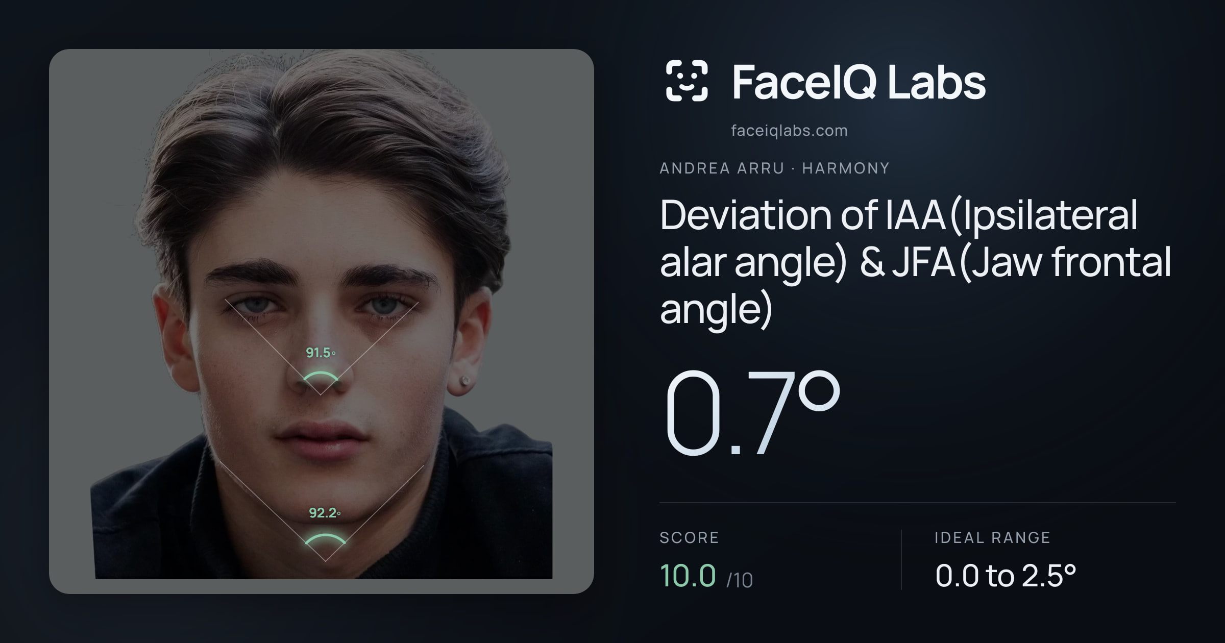 Andrea Arru Deviation of IAA(Ipsilateral alar angle) & JFA(Jaw frontal angle): 0.7°, drawn on the photo
