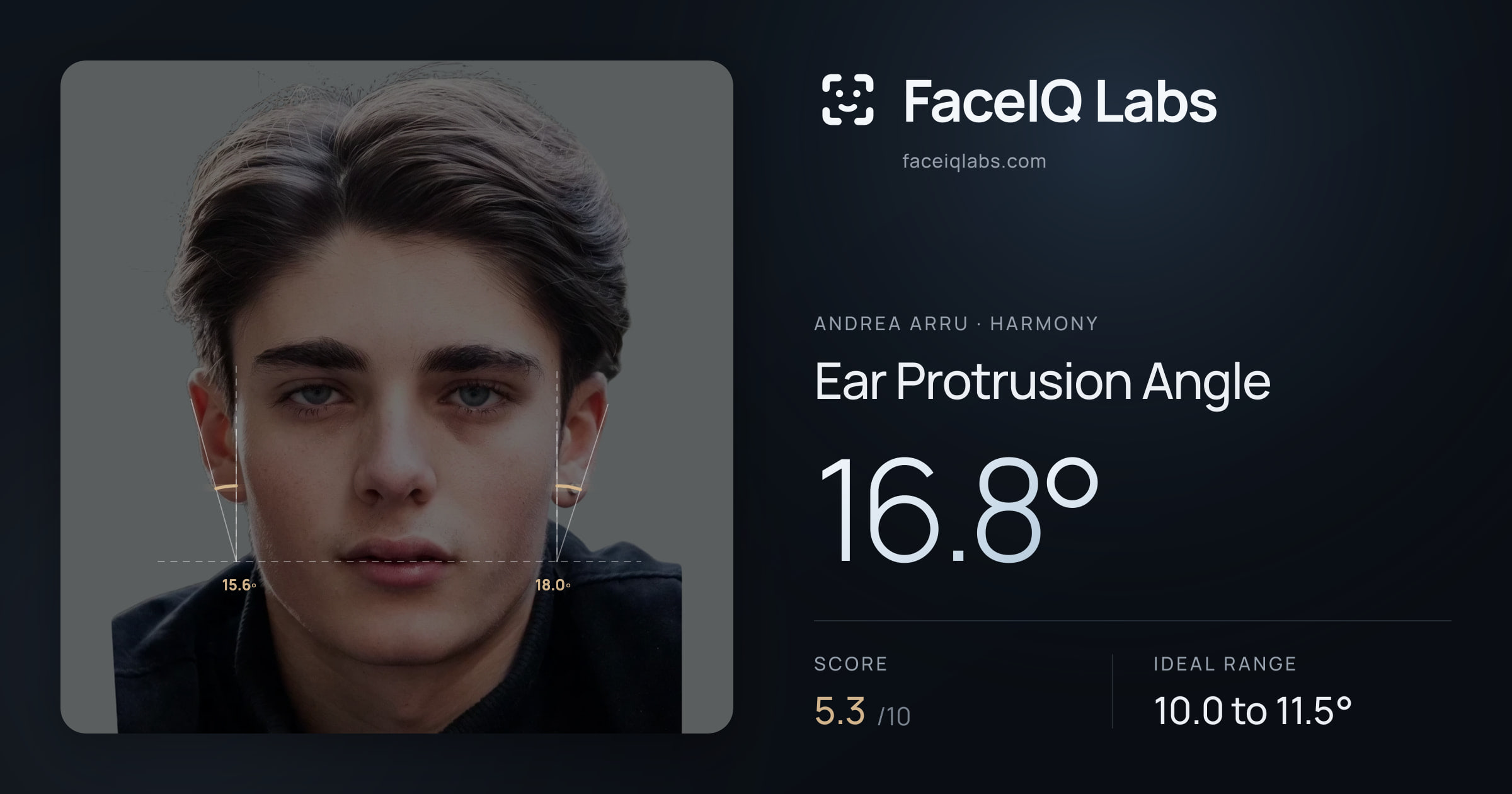 Andrea Arru Ear Protrusion Angle: 16.8°, drawn on the photo