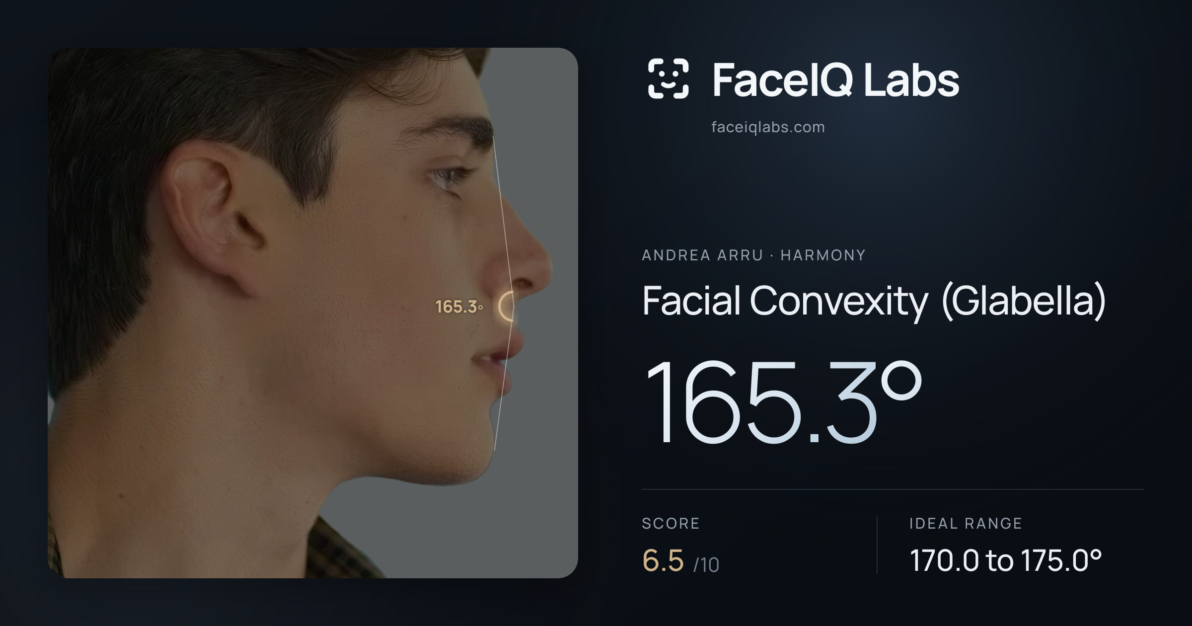 Andrea Arru Facial Convexity (Glabella): 165.3°, drawn on the photo