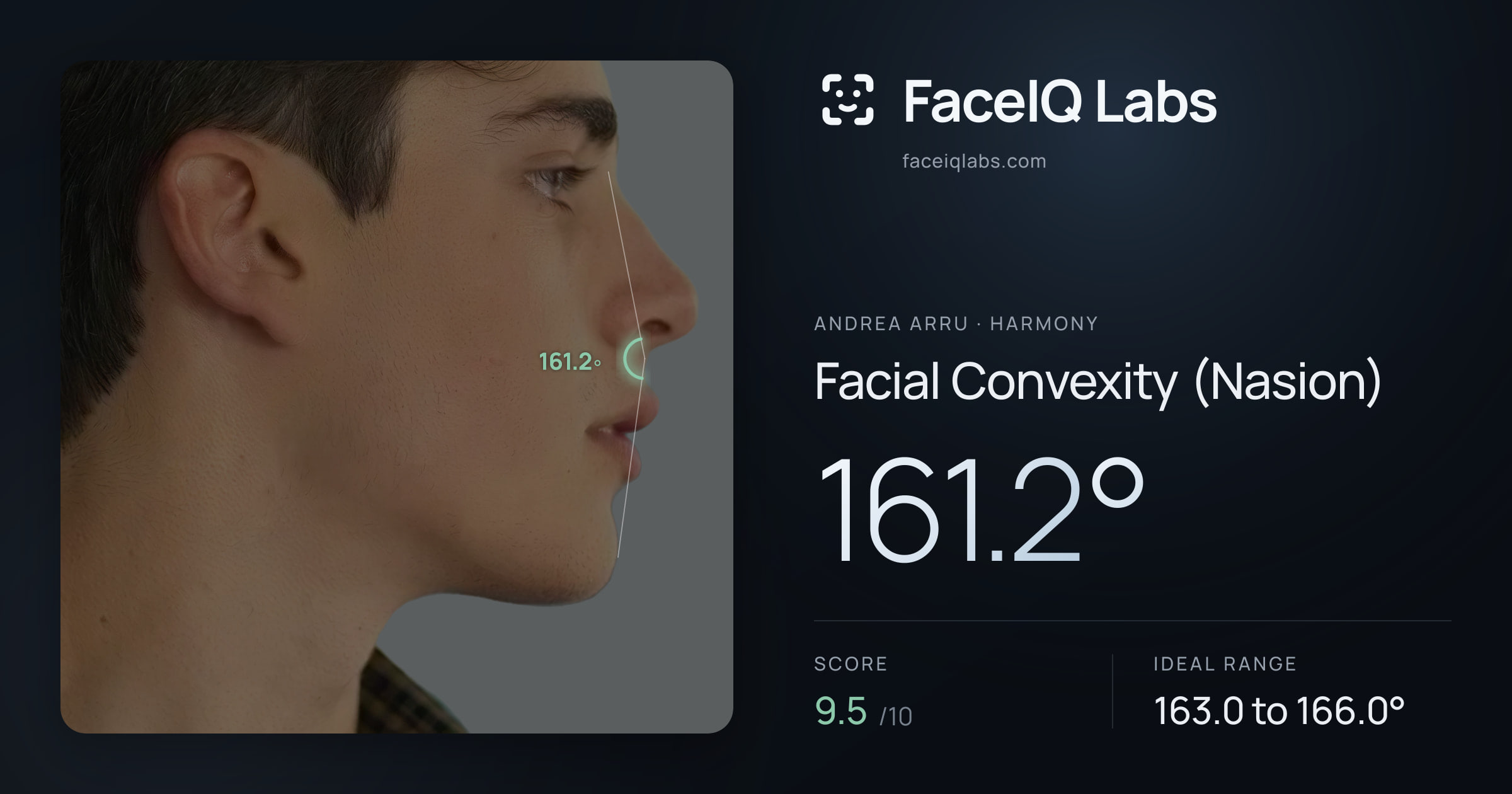Andrea Arru Facial Convexity (Nasion): 161.2°, drawn on the photo