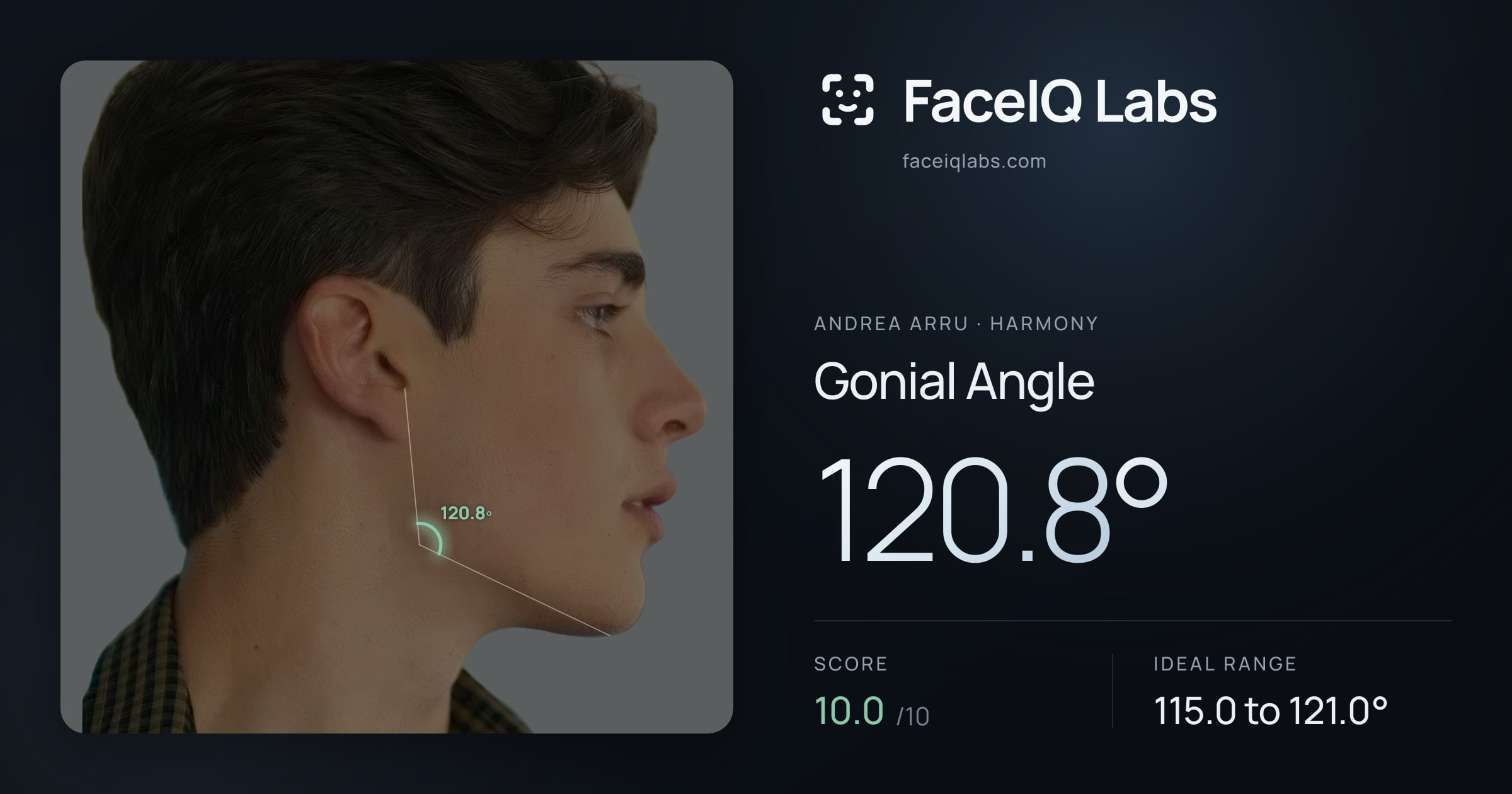 Andrea Arru Gonial Angle: 120.8°, drawn on the photo