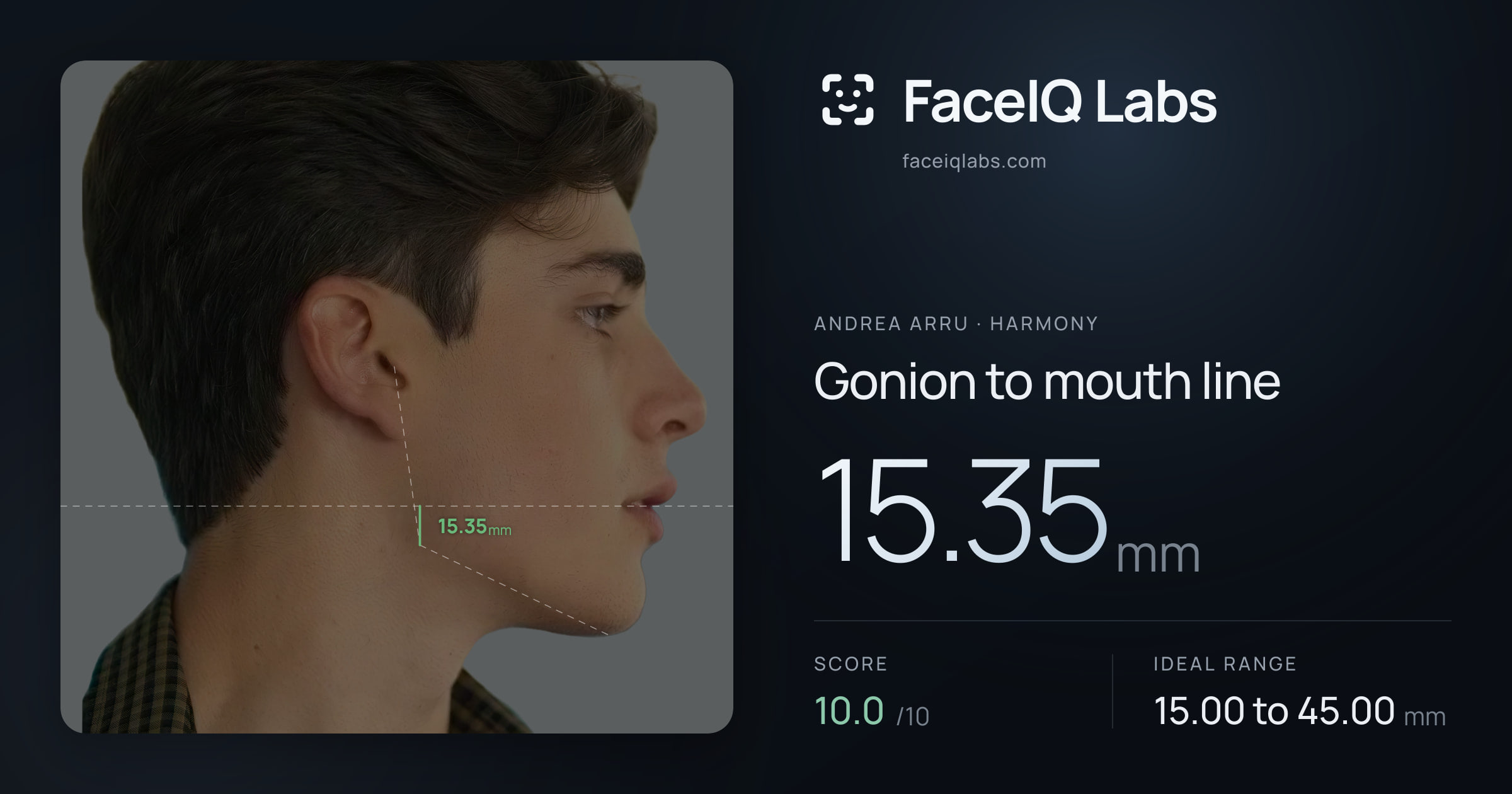 Andrea Arru Gonion to mouth line: 15.35mm, drawn on the photo