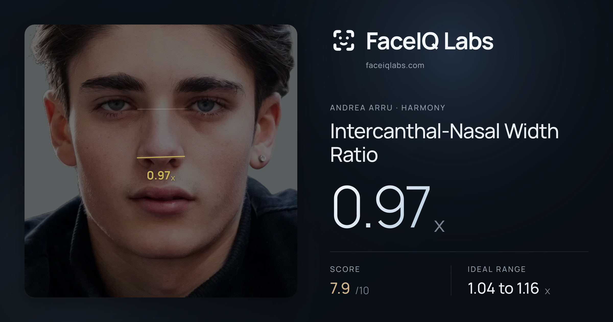 Andrea Arru Intercanthal-Nasal Width Ratio: 0.97x, drawn on the photo