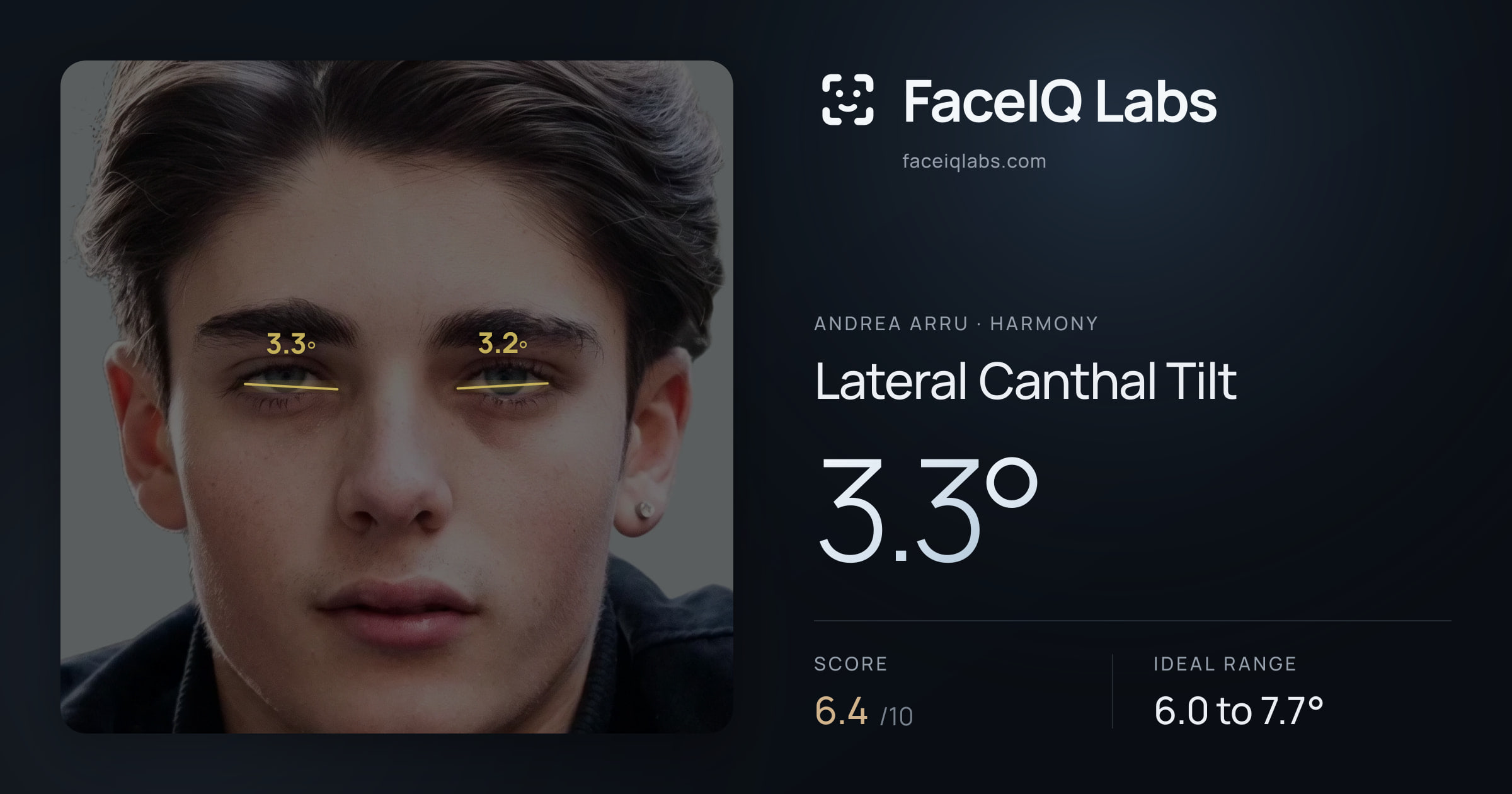 Andrea Arru Lateral Canthal Tilt: 3.3°, drawn on the photo