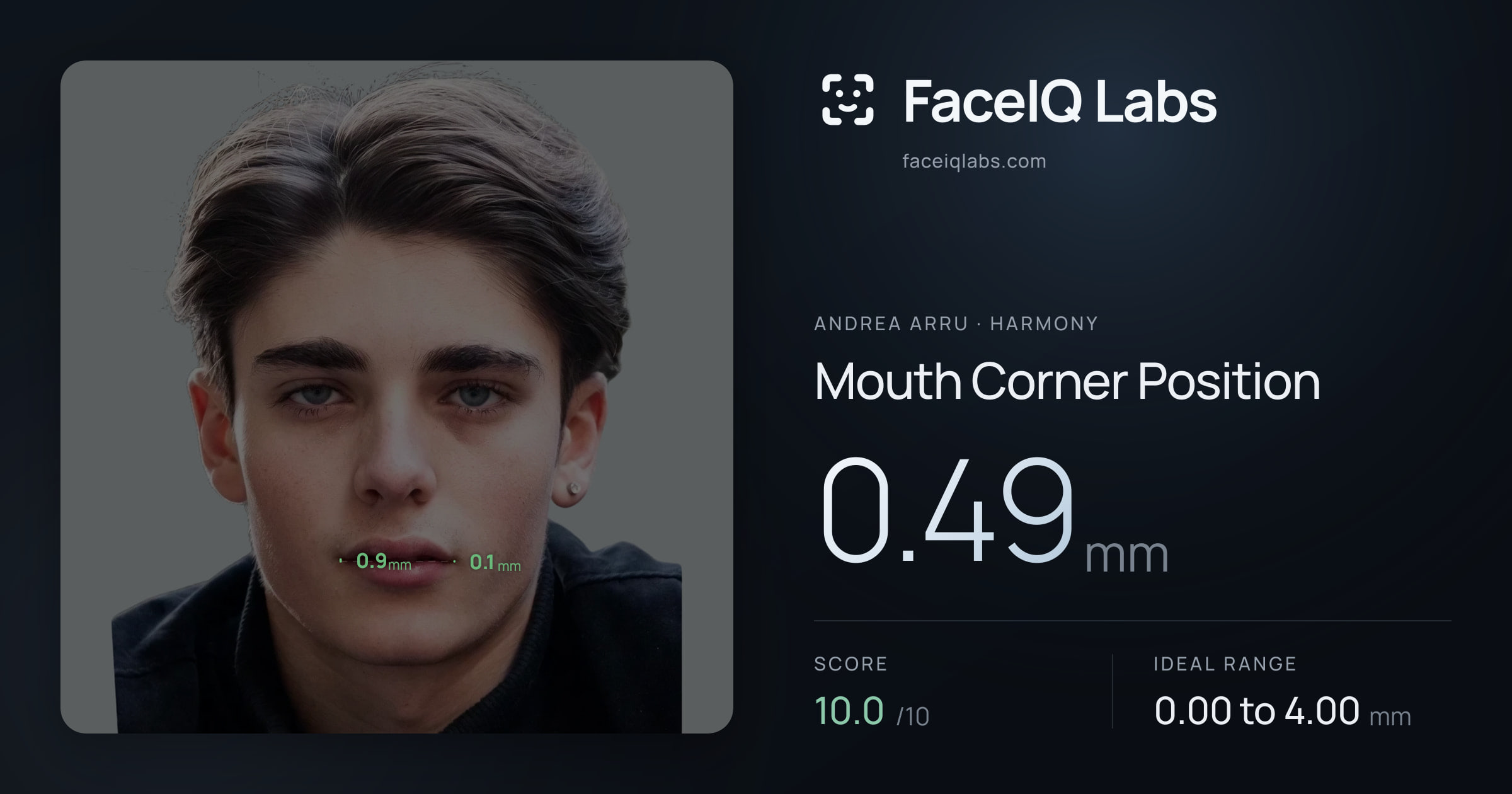 Andrea Arru Mouth Corner Position: 0.49mm, drawn on the photo