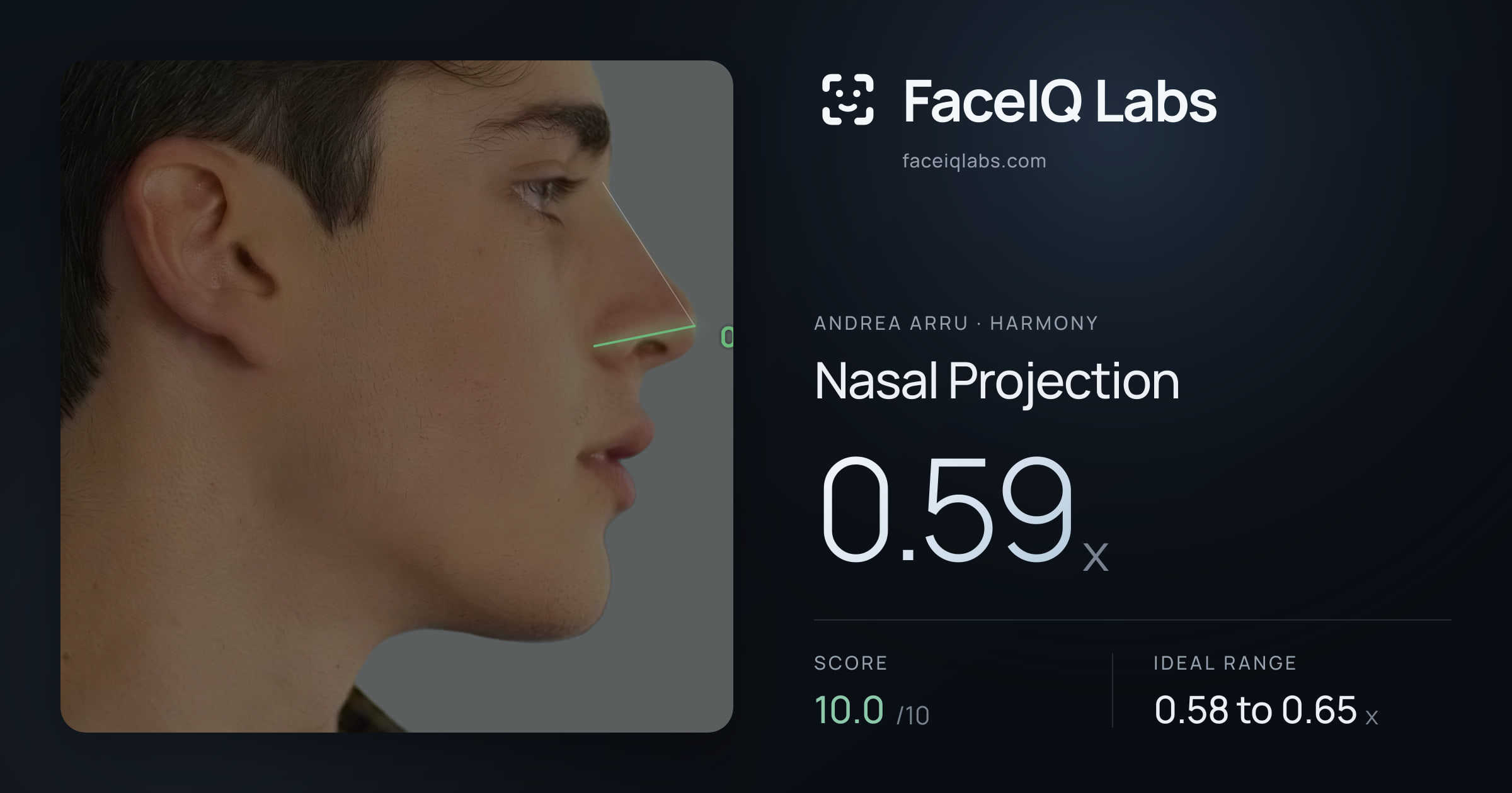 Andrea Arru Nasal Projection: 0.59x, drawn on the photo
