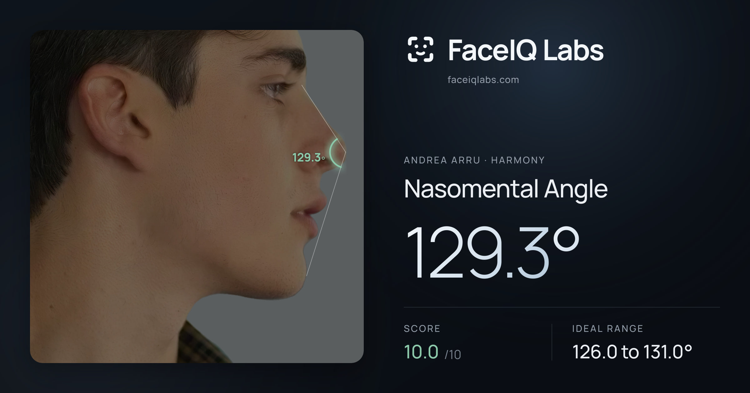 Andrea Arru Nasomental Angle: 129.3°, drawn on the photo