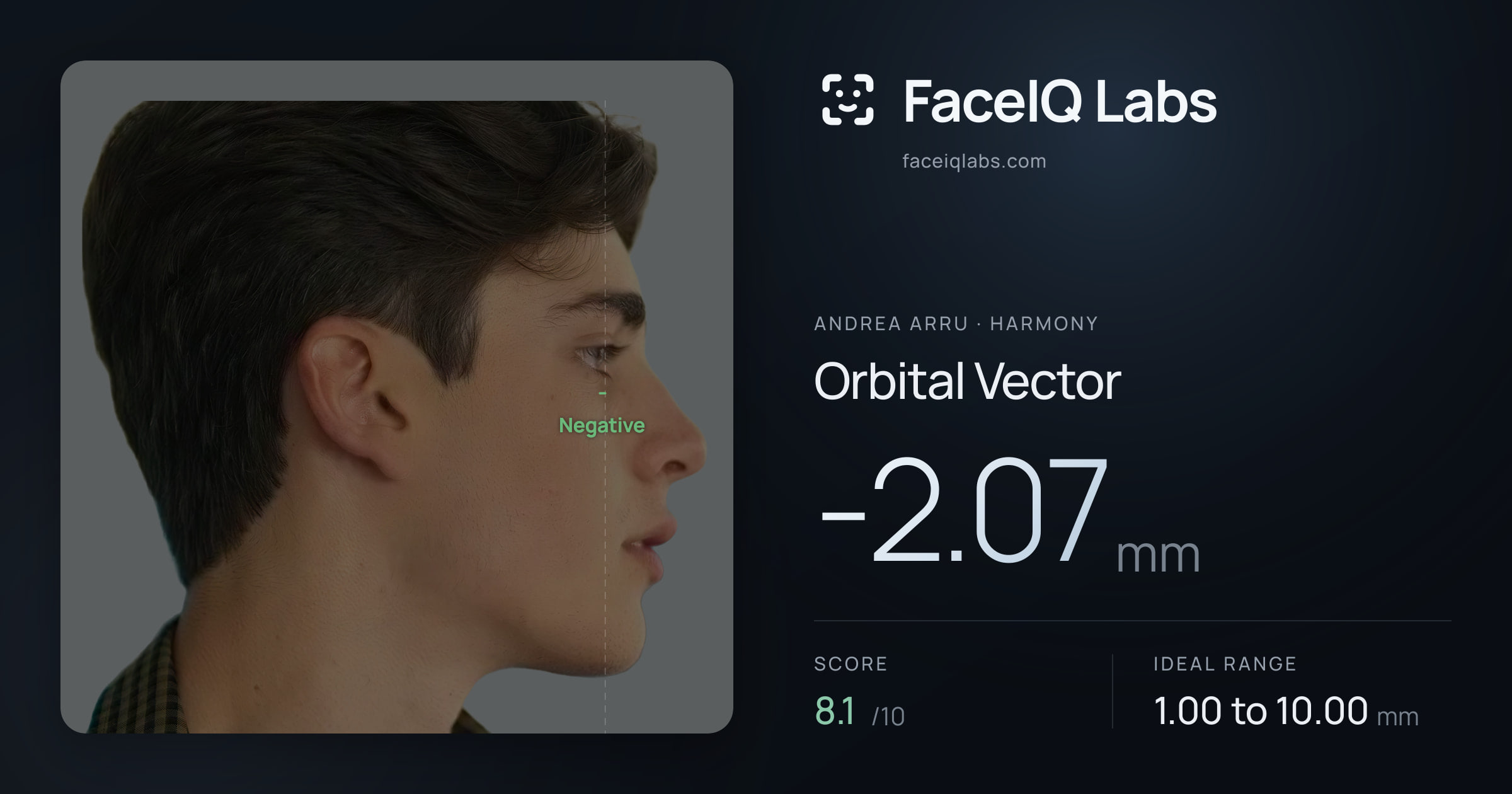 Andrea Arru Orbital Vector: -2.07mm, drawn on the photo