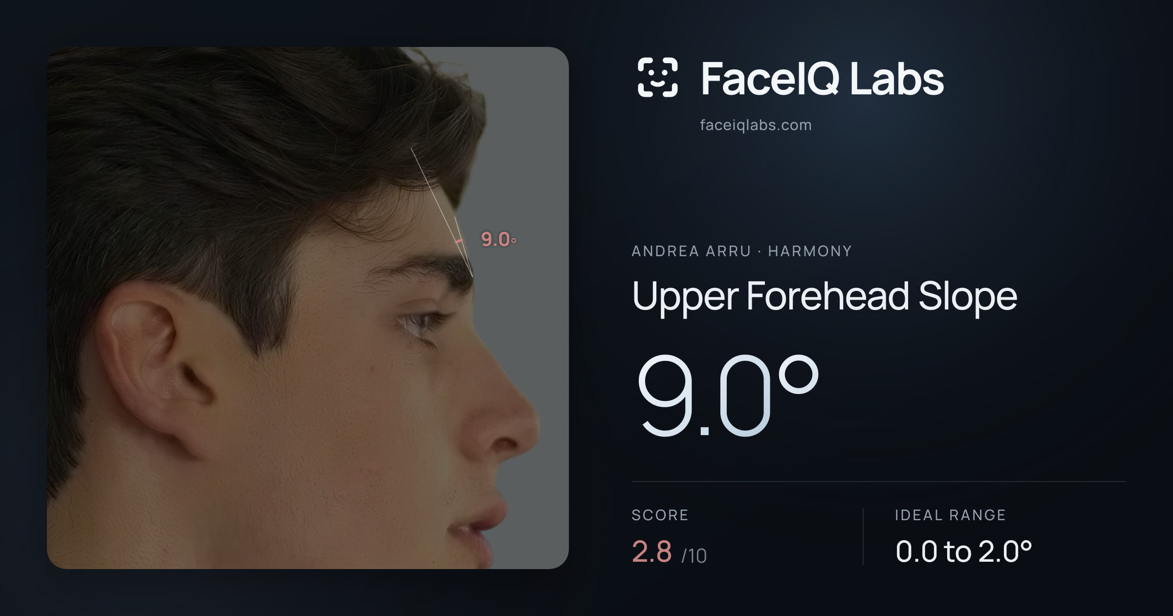 Andrea Arru Upper Forehead Slope: 9.0°, drawn on the photo