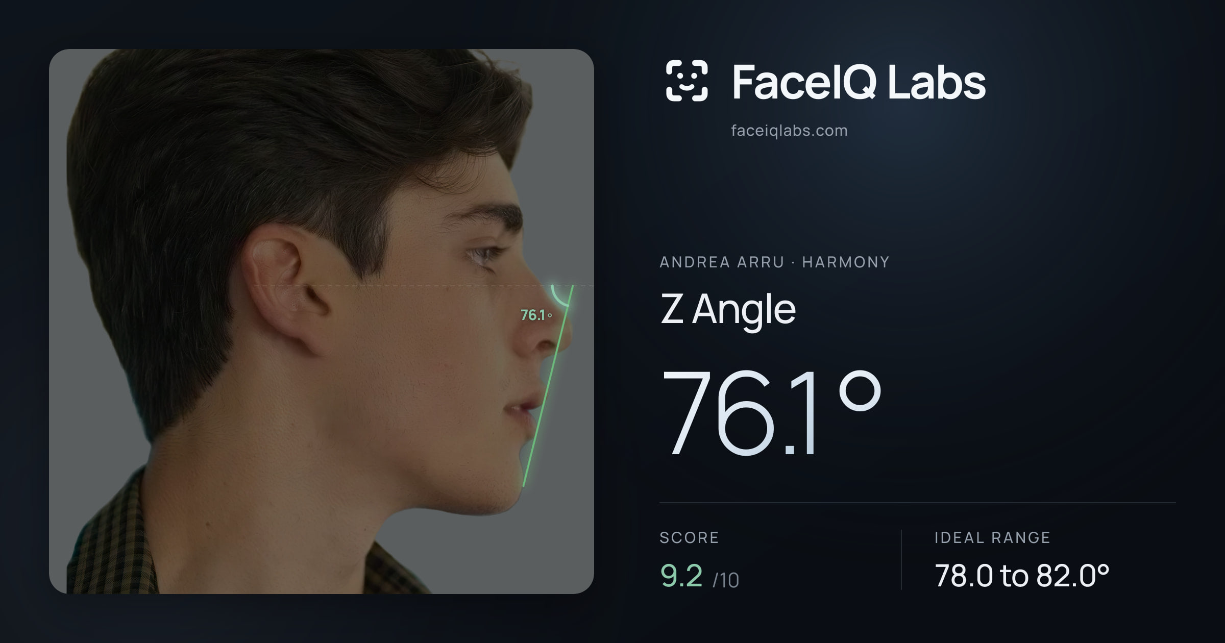 Andrea Arru Z Angle: 76.1°, drawn on the photo
