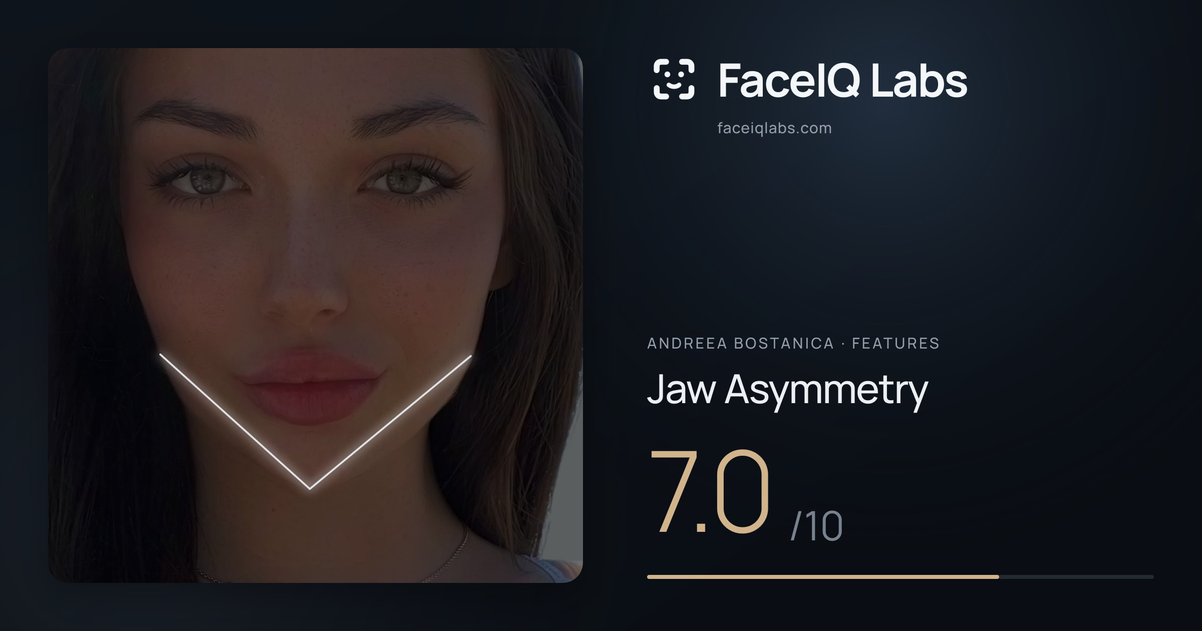Andreea Bostanica Jaw Asymmetry: 7.0/10, drawn on the photo